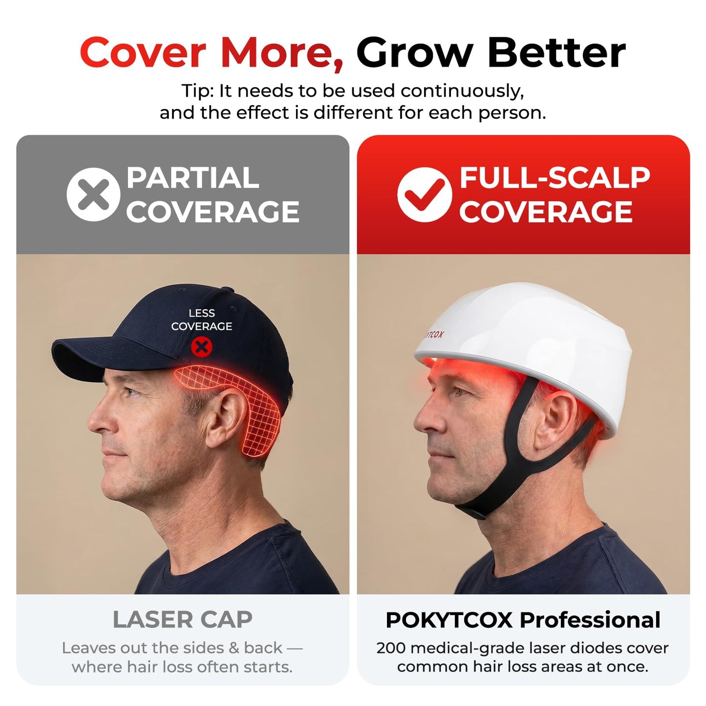 Laser Red Light Therapy for Hair Growth,FDA Cleared Hair Growth Device for Men & Women,650nm Low Level Laser Therapy for Thinning Hair & Alopecia, 200 Lasers Full Scalp Coverage Home Use(KCA451-200S)