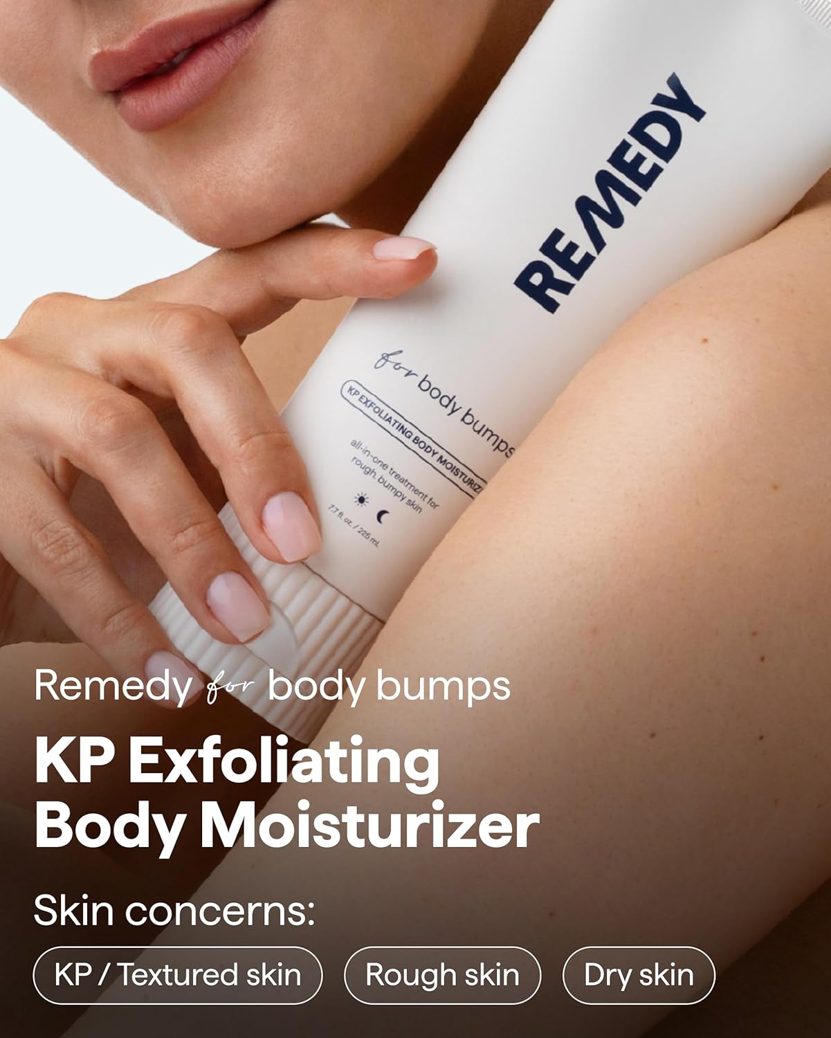 KP Body Moisturizer - Keratosis Pilaris Treatment with Retinol, Urea & Lactic Acid | Exfoliating Lotion, 7.7 fl oz