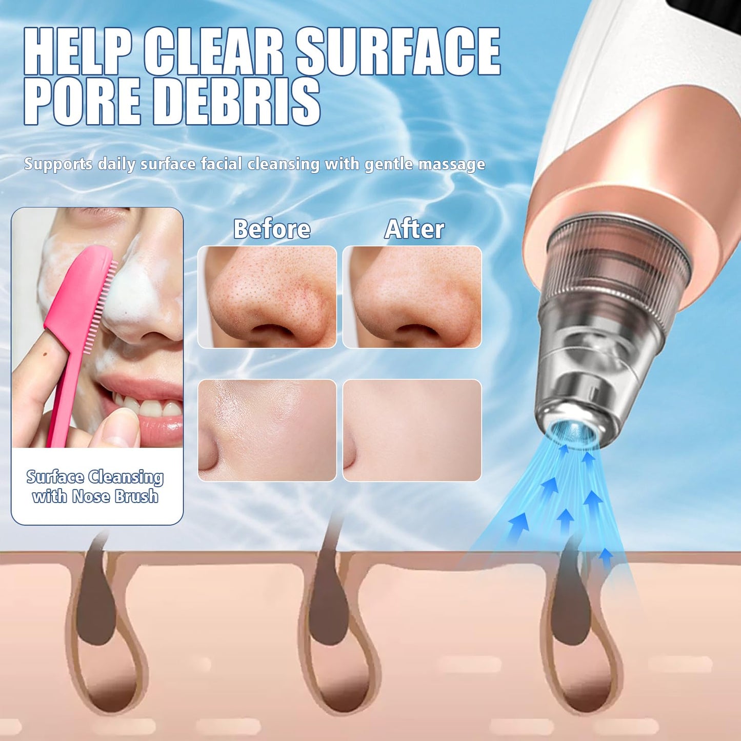 Blackhead Remover Pore Vacuum, with Nose Brush & Skin Care Tools, 3 Adjustable Suction Levels, 5 Suction Power,5 Probes, USB Rechargeable Facial Cleaner for Daily Surface Cleansing (White)
