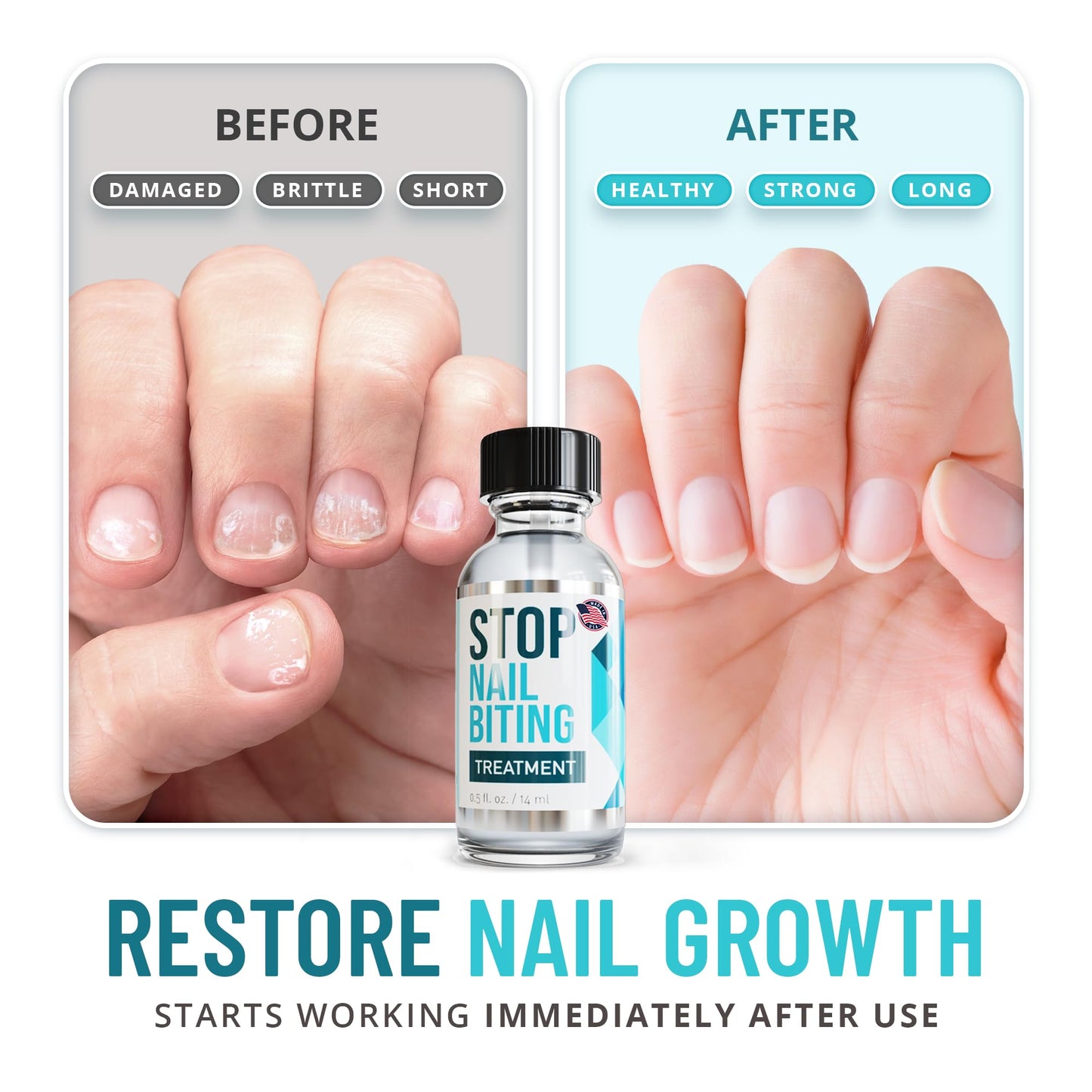 Stop Nail Biting Treatment for Kids & Adults – Bitter Taste No-Bite Nail Polish, Thumb Sucking Deterrent, Non-Toxic Safe Formula, Supports Healthy Nails – 0.5 fl oz
