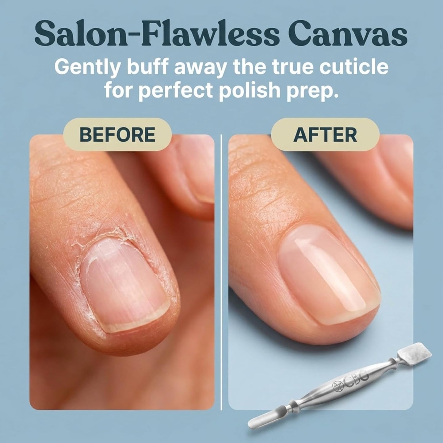 Nail Care Cuticle Remover Tool - Interchangeable Attachments for Gentle Grooming | Travel-Friendly for Finger & Toe Nails