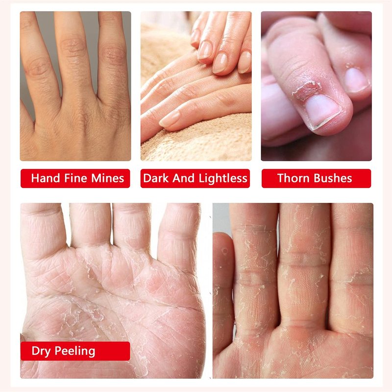 Moisturizing Gloves - 4 Pack Hand Spa Mask with Collagen & Vitamins | Repair Dry, Cracked Skin for Men & Women