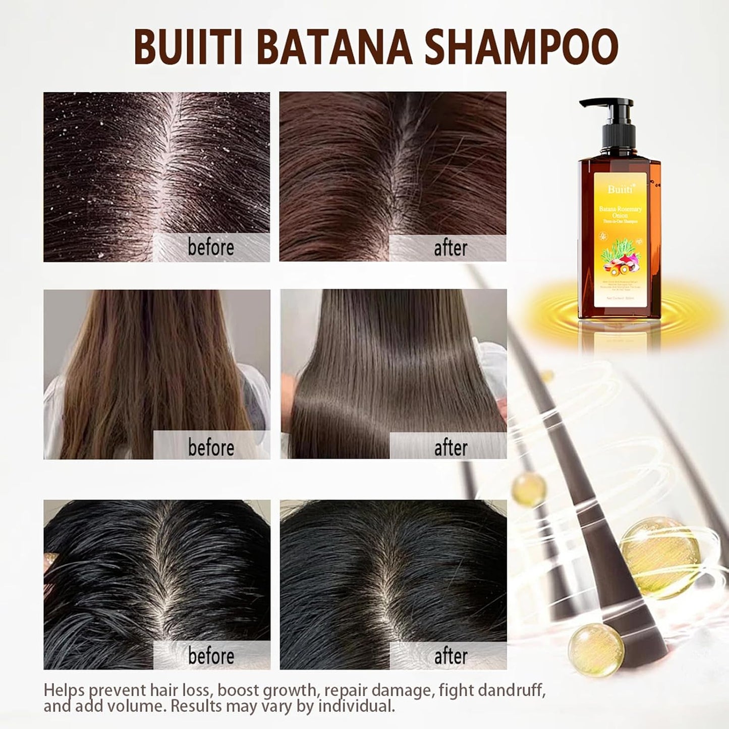 Batana Oil Shampoo for Hair Growth - Rosemary & Onion Infused, Anti-Hair Loss Treatment, 10.14 fl oz (2PCS)