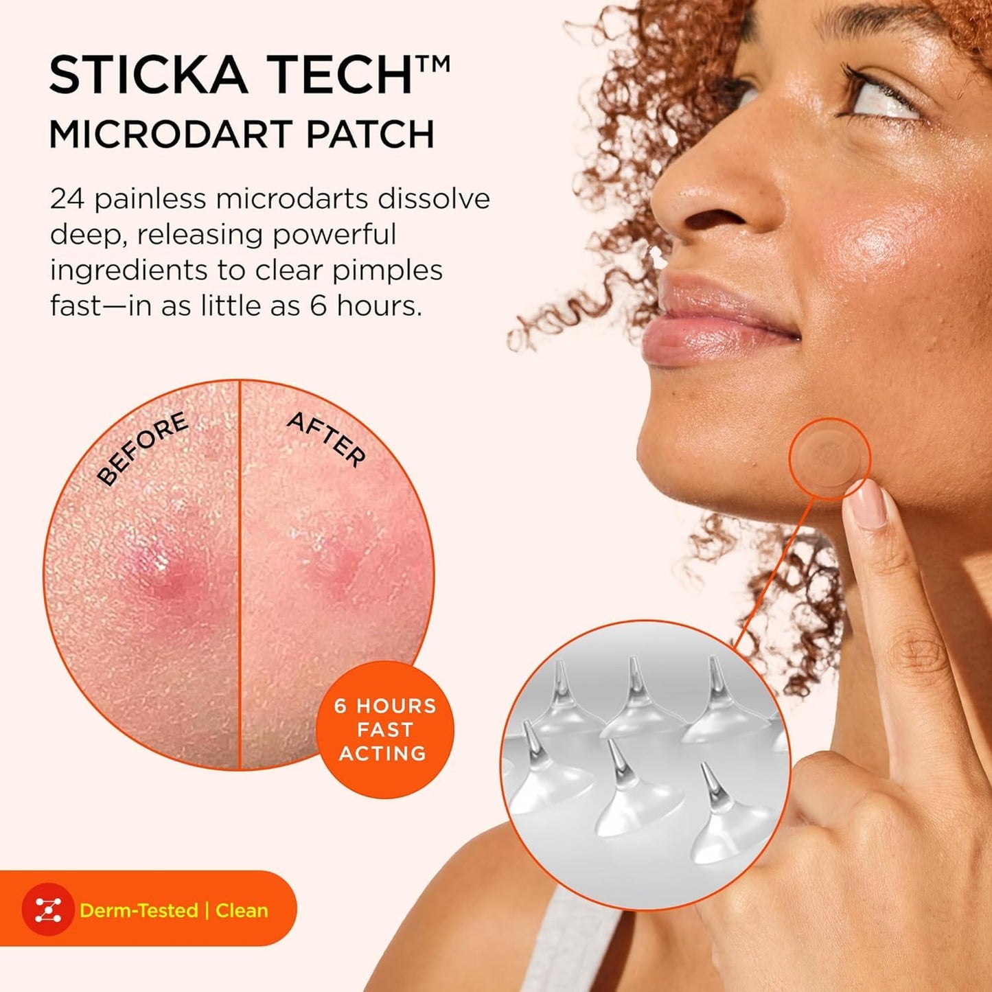 ZitSticka Killa Microdart Pimple Patches - Fast-Acting Salicylic Acid Treatment for Deep Zits | Regular 8 Count