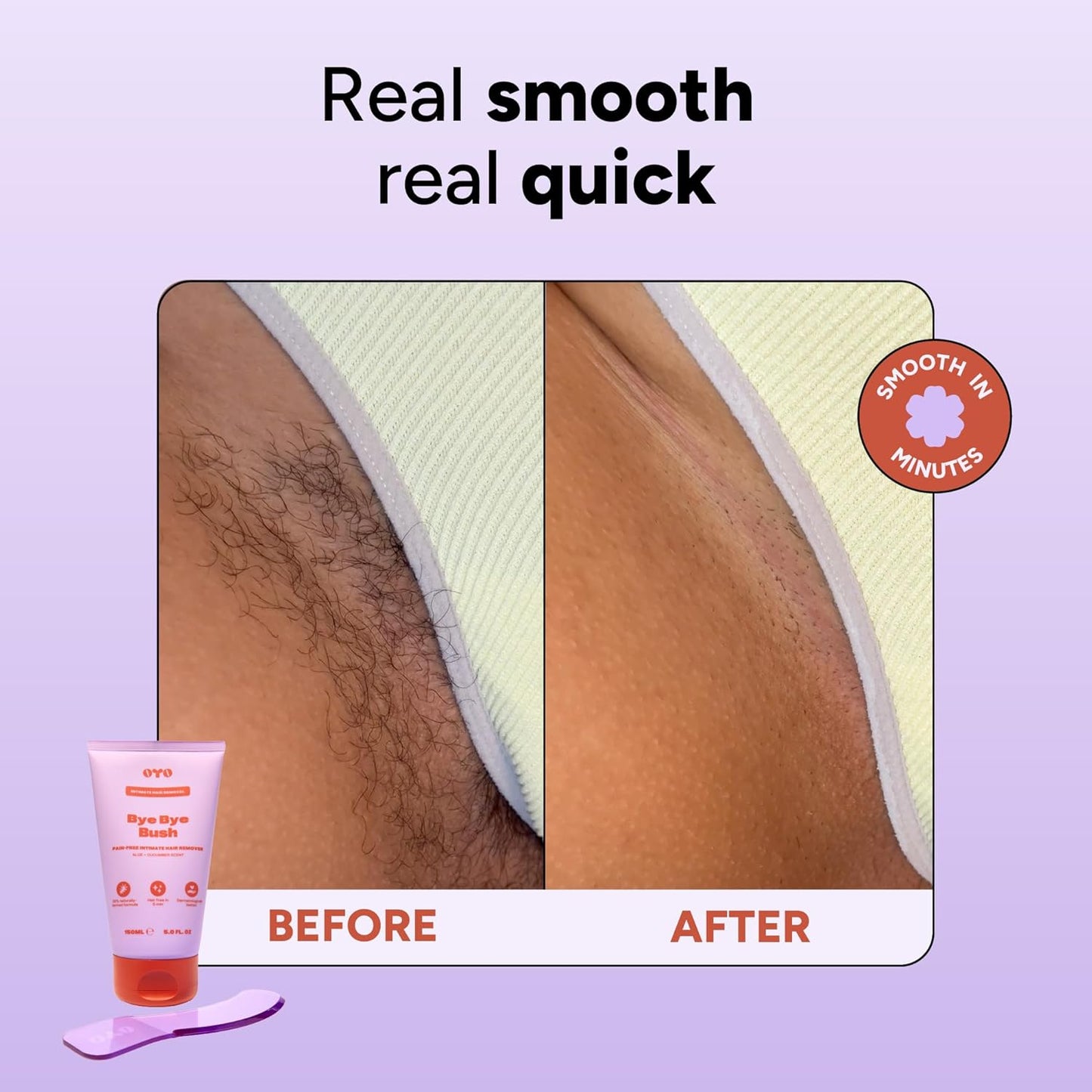 Hair Removal Cream for Women - Sensitive Skin Formula with Aloe & Cucumber | 5 fl oz for Bikini, Thighs & Armpits