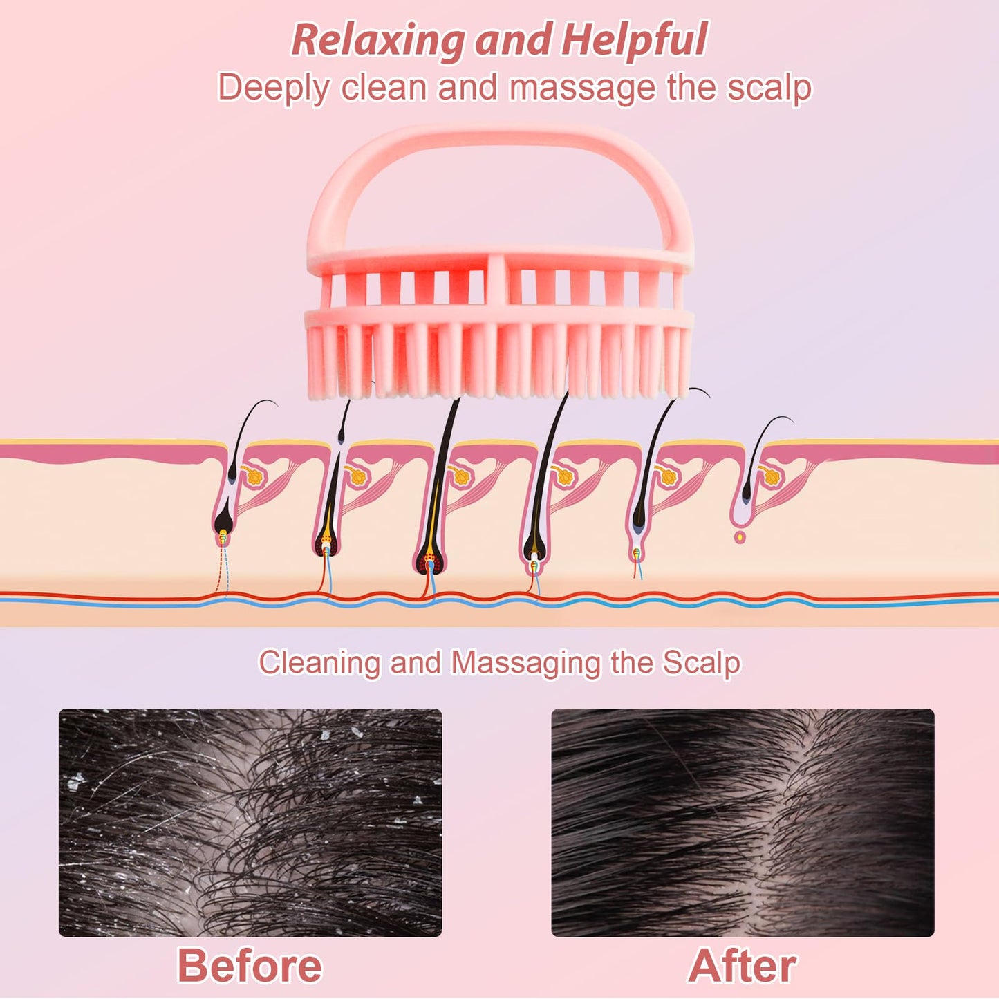 DUAIU Hair Oil Applicator with Continuous Spray Bottle Hair Scalp Massager, Silicone Root Comb Applicator Bottle Shampoo Brush and Mister Spray Bottles for Hair Dye and Hair Care