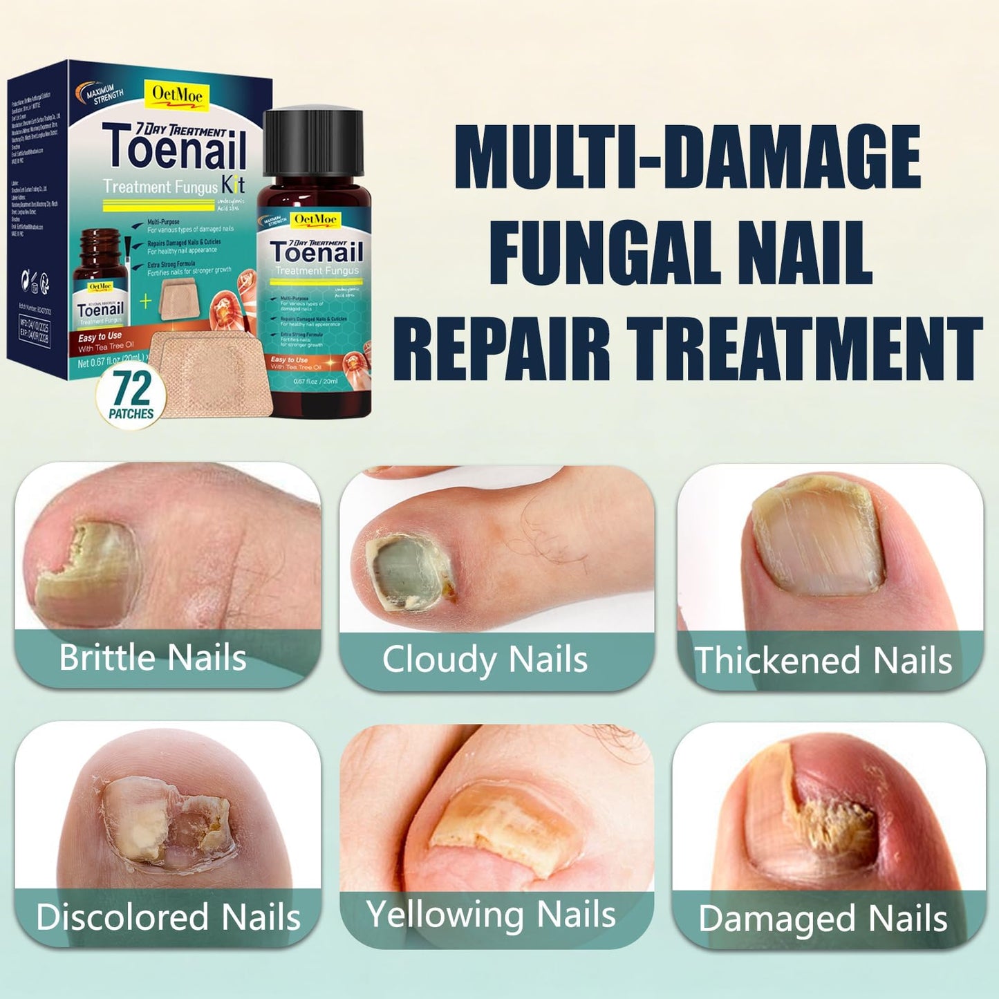 Toenail Treatment Extra Strength Kit, 7-Days Nail Treatment with 25% Undecylenic Acid & 72 Nail Patches, Repairs Yellow, Thick, Discolored & Broken Nails