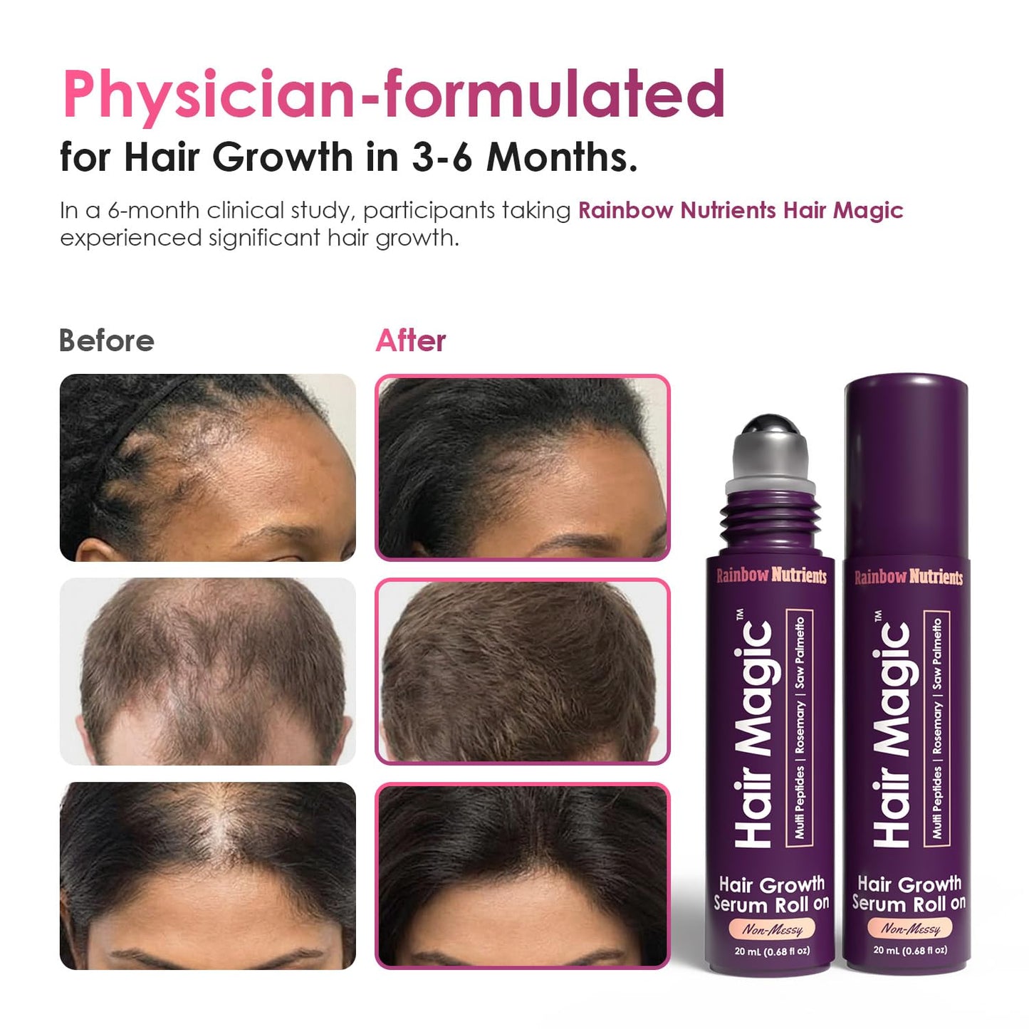 Hair Magic™ Hair Growth Serum - Multi-Peptide & Rosemary Oil Treatment for Hair, Beard, Eyebrows | Unisex Scalp Solution