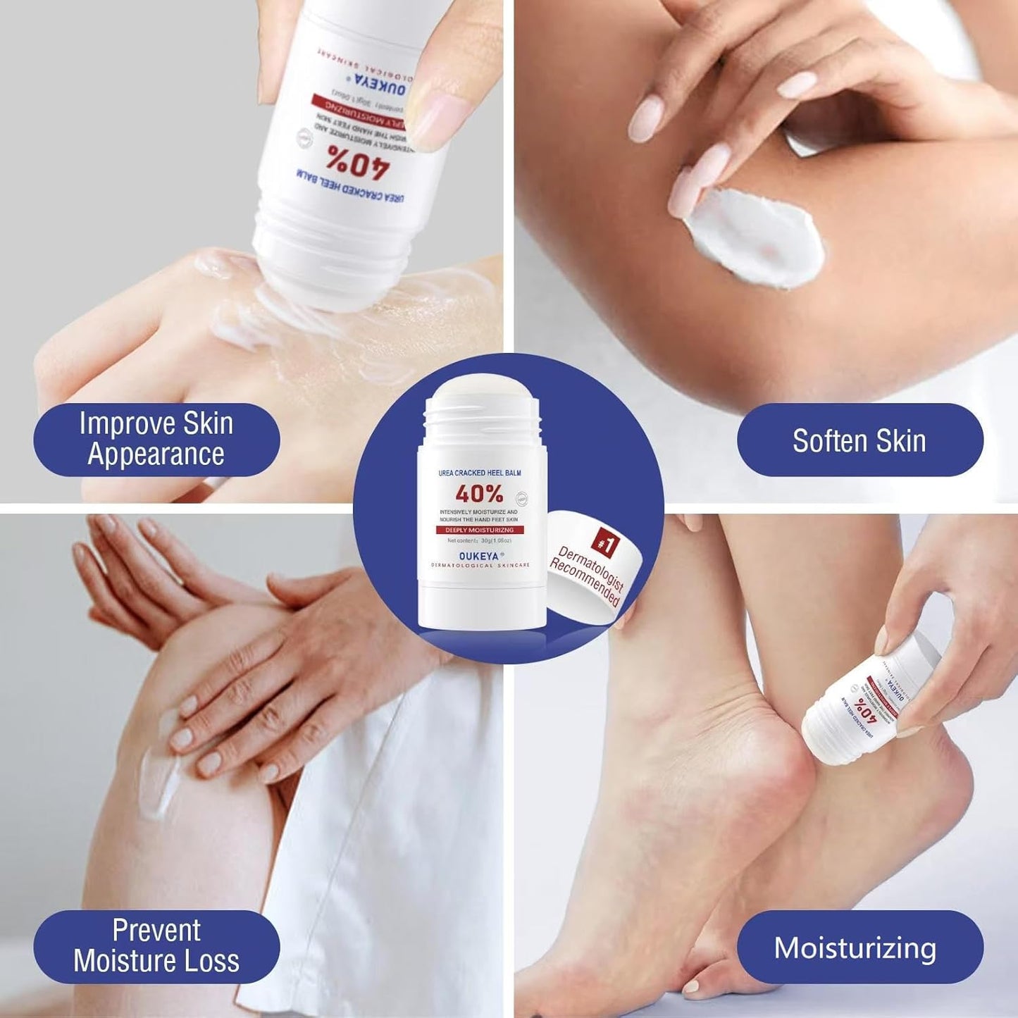 Urea Cream Stick 40% - Maximum Strength Foot & Hand Balm for Dry, Cracked Skin | 1.06 oz