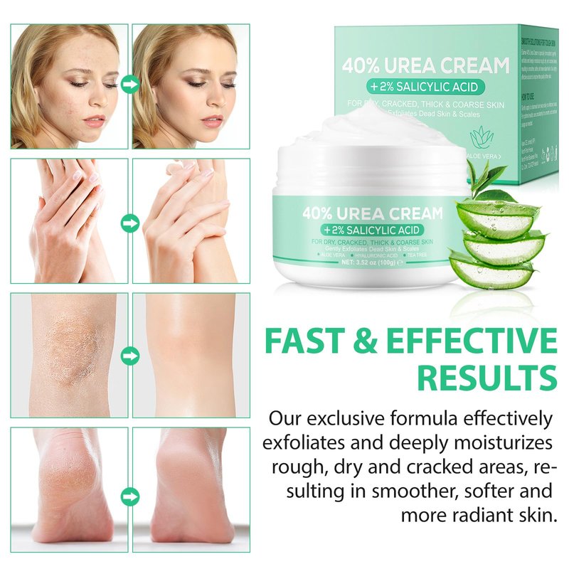 Urea Cream 40 Percent For Feet Maximum Strength,40% Urea Cream Plus 2% Salicylic Acid with Hyaluronic Acid,Tea Tree,and Aloe Vera for Foot and Hand - Deep Moisturizes,Callus Remover 3.53 oz