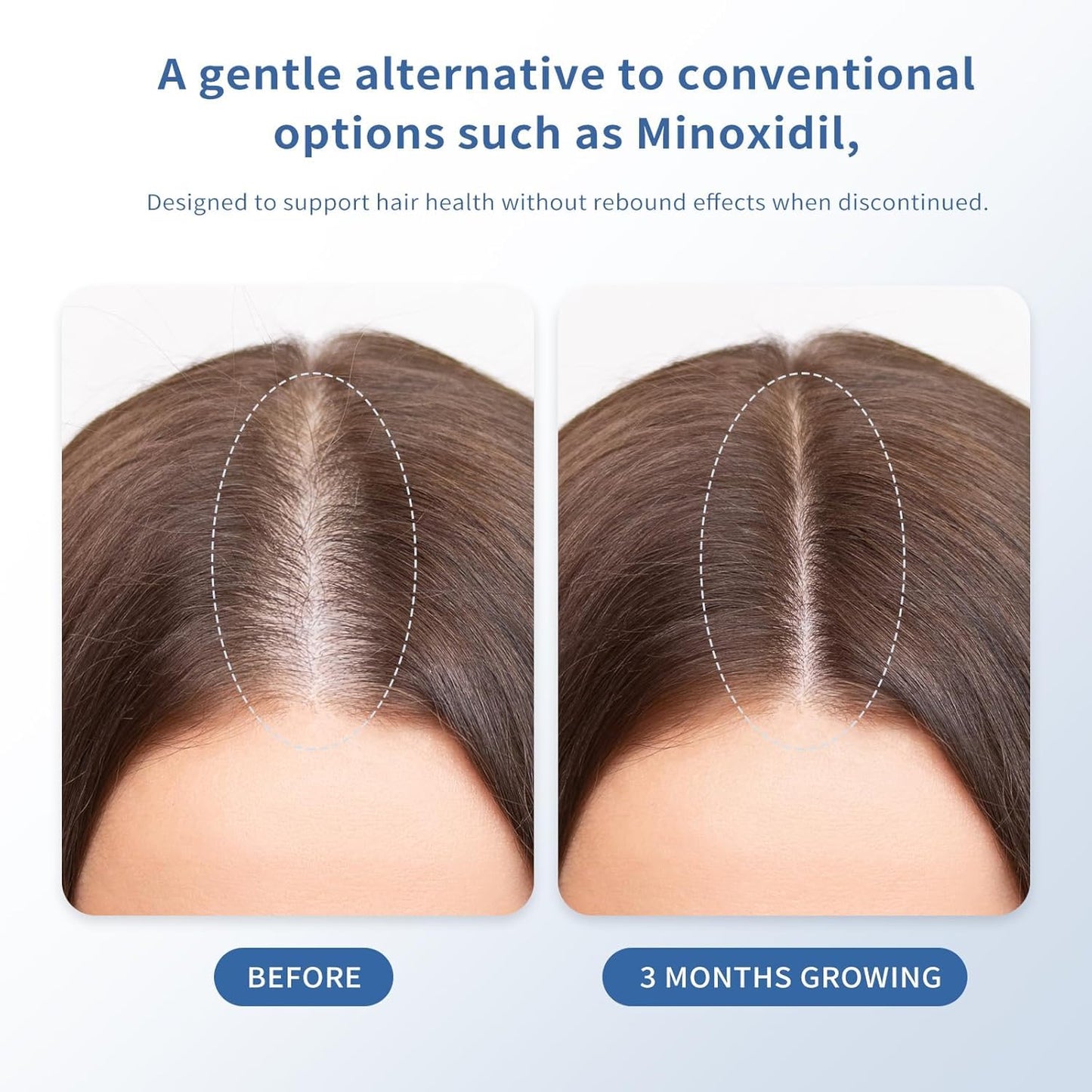 Hair Growth Serum for Thinning Hair - Strengthens & Thickens with Biotin | Fast-Absorbing Roll-On (30ml)