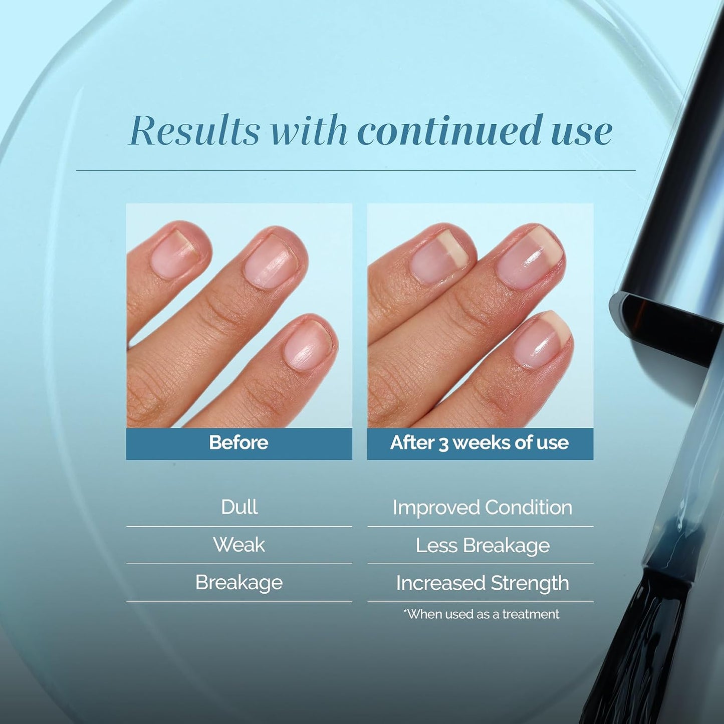 Nail Strength and Growth Treatments - Strengthen, Repair & Shine | Clear Formula for Weak, Brittle Nails