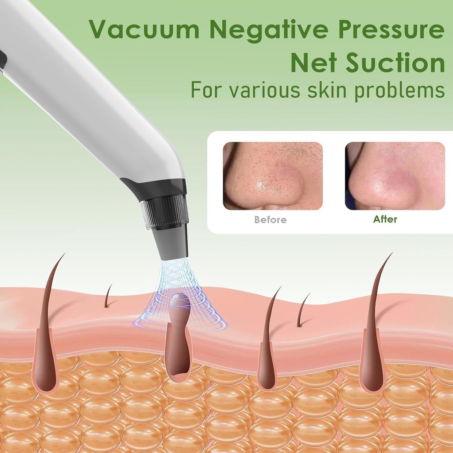Blackhead Remover Pore Vacuum - Electric Facial Cleanser with 4 Probes & 3 Suction Levels | USB Rechargeable, White
