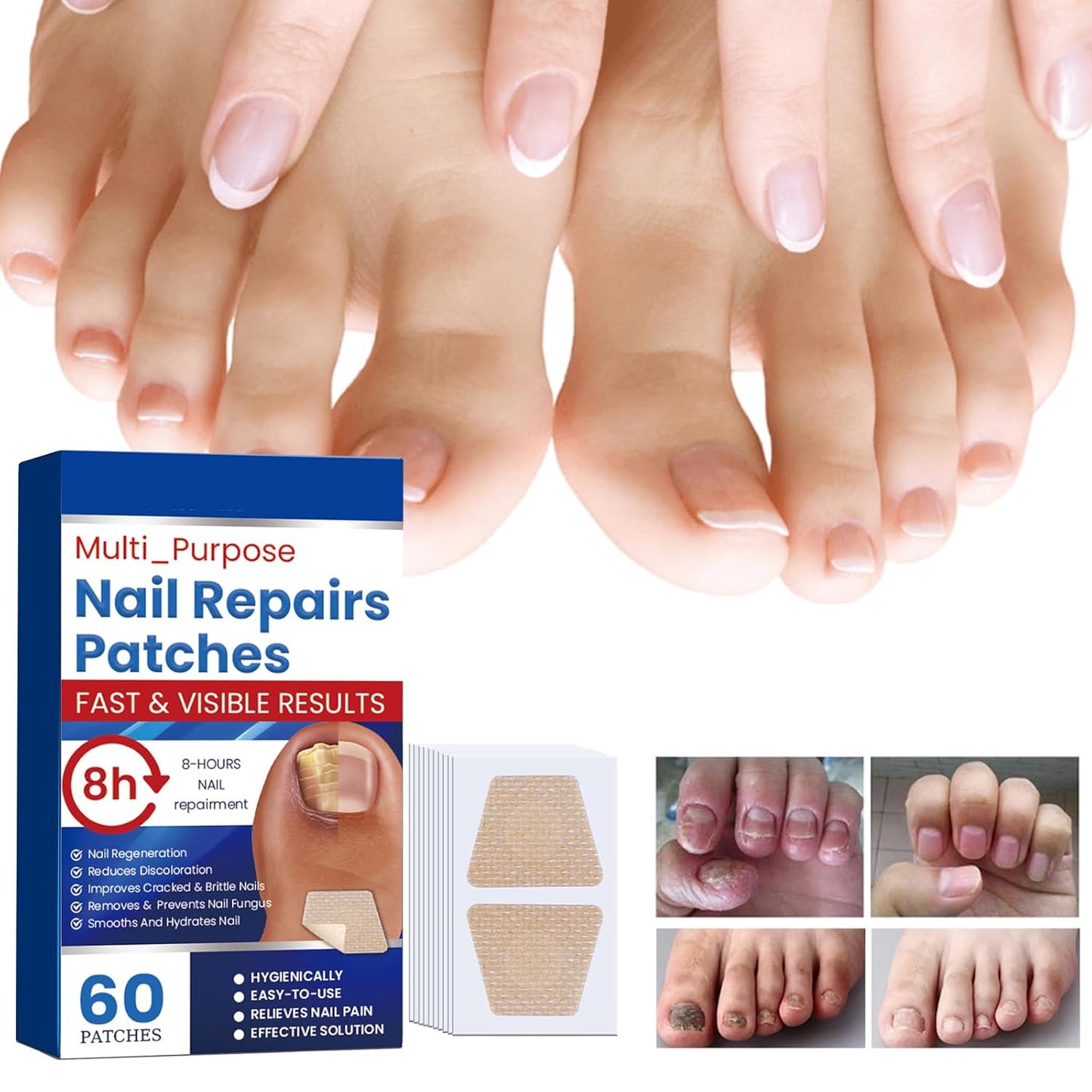 Nail Fungal Repair Patches - Extra Strength Treatment for Healthy Nails | 60 Pcs, 8-Hour Overnight Solution