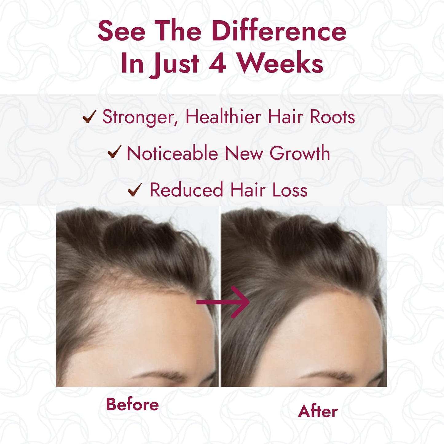 Redensyl Hair Serum Roll On – 3% Rosemary & 3% Redensyl Scalp Treatment for Thicker, Fuller Looking – Nourishing Hair Density Support for Women Pink (30 ml)