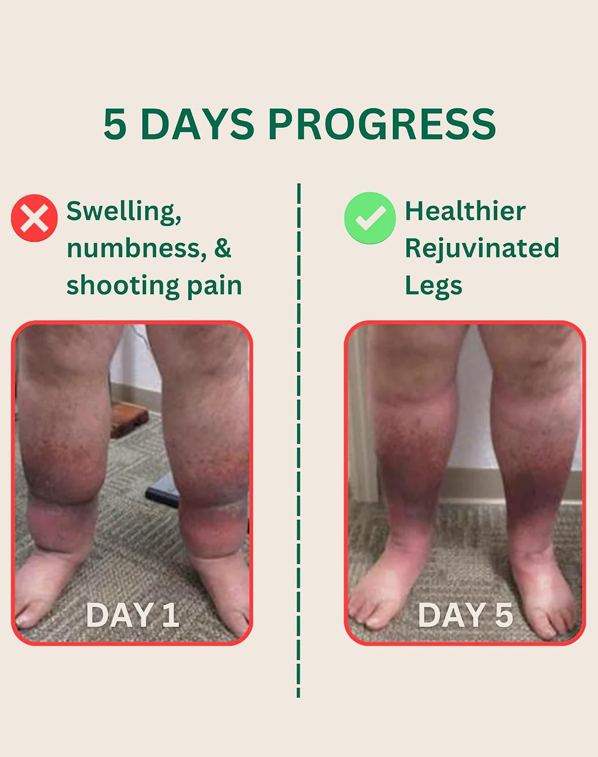 Senzio Miracle Balm - Herbal Relief for Swollen Legs & Nerve Discomfort | Asian Medicinal Herbs, 1 oz