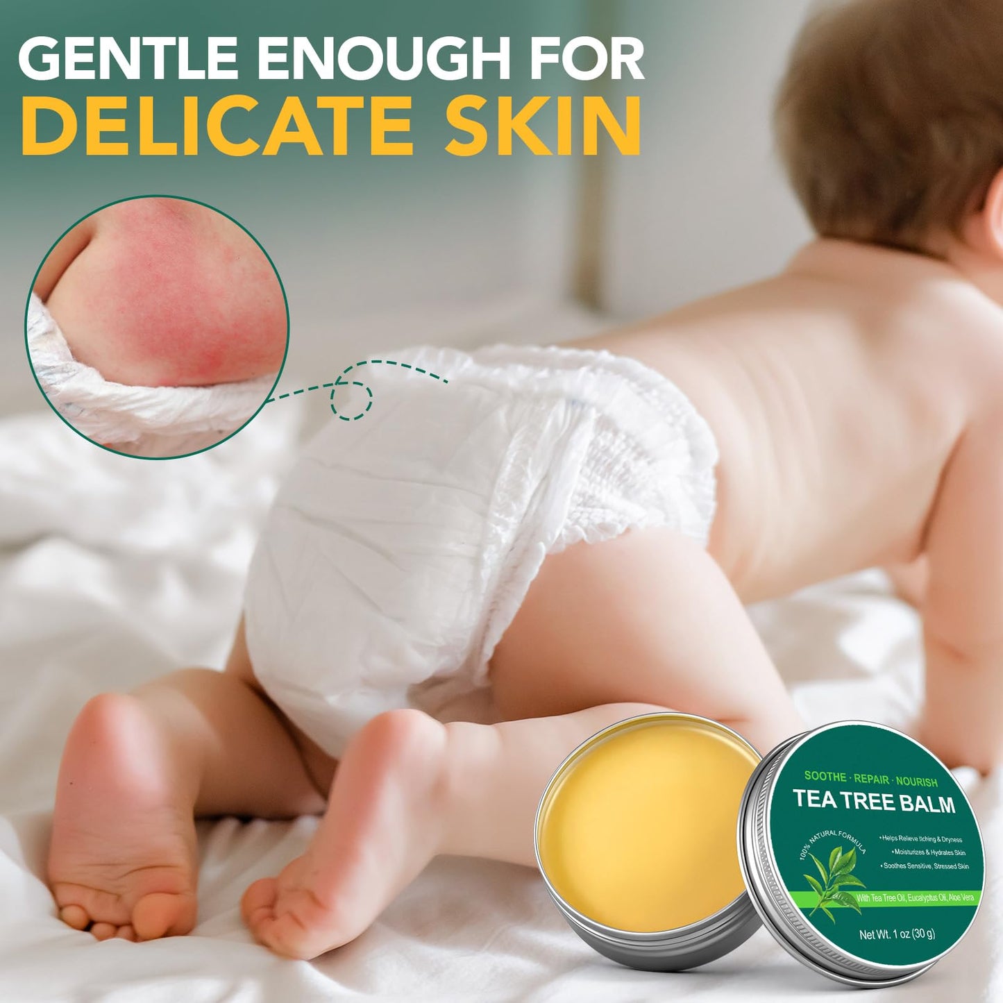 bnHUlMXw Tea Tree Oil Balm,Tea Tree Oil for Skin,Dry Itchy Skin & Rash Relief, Athlete’s Foot & Dry Feet Itching, Jock Itch, Chafing, Bug Bites,Natural Formula,Effective & Safe for All Ages