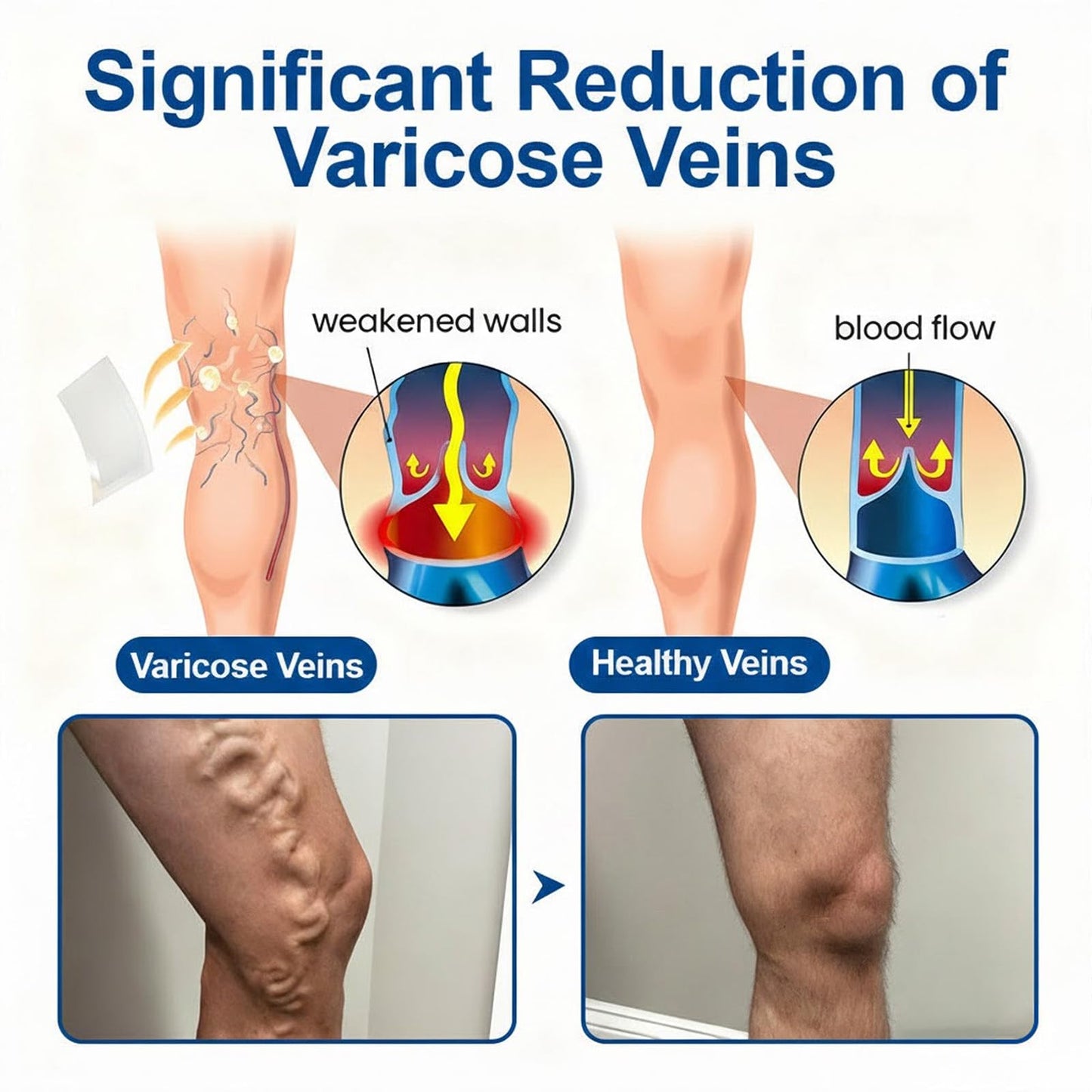 Luhaka GLORENDA Vein Contour Microdarts Patch, Vein Target Microdarts Patch, Relieve Leg Discomfort, Soothes Leg Discomfort, Effectively Moisturizes and Moisturizes (2PCS)