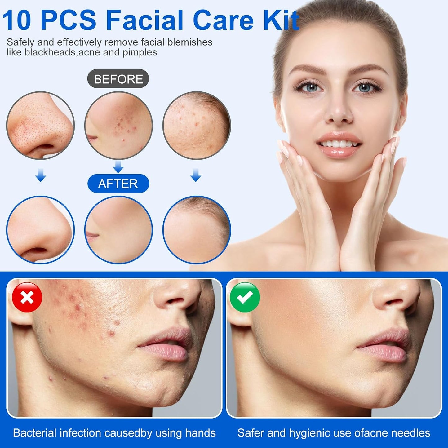 Pimple Popper Tool Kit - 10-Piece Blackhead Remover Set | Professional Comedone Extractors for Acne & Zit Removal, Metal Box Included (Silver)