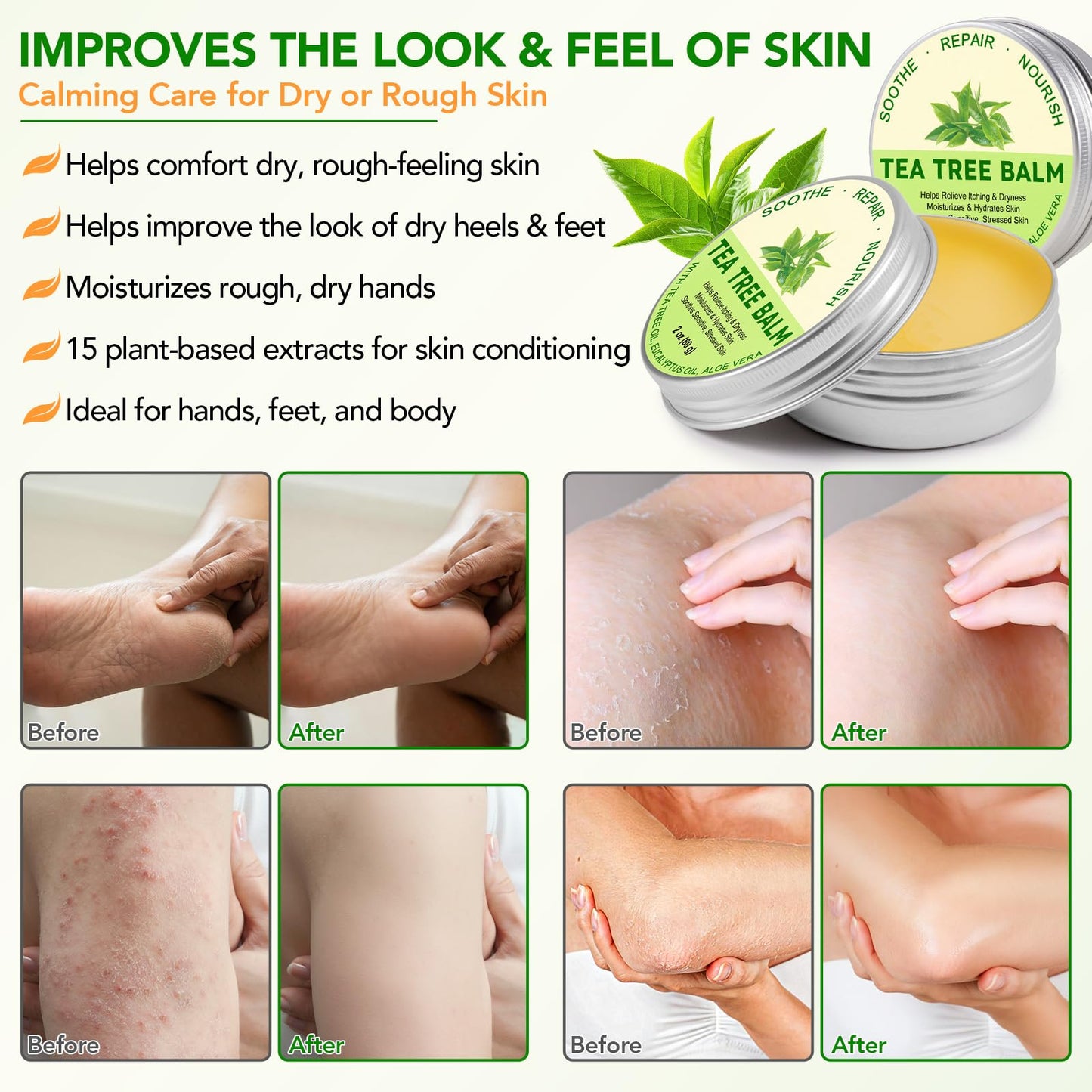 ABOUME Tea Tree Oil Balm, Tea Tree Balm Help Dry, Itchy & Fungal-Prone Skin, Soothing Moisturizing Balm Suitable for Feet, Heels, Hands & Body, Natural Formula, 60g (1PCS)