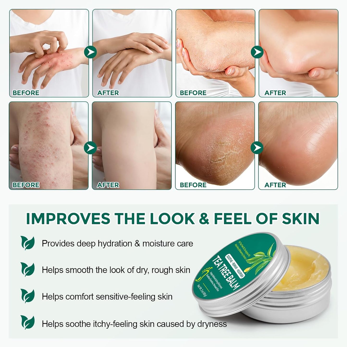 Tea Tree Oil Balm - Soothing Moisturizing Balm for Dry & Sensitive Skin | 2 oz, Natural Relief for Itchy Areas
