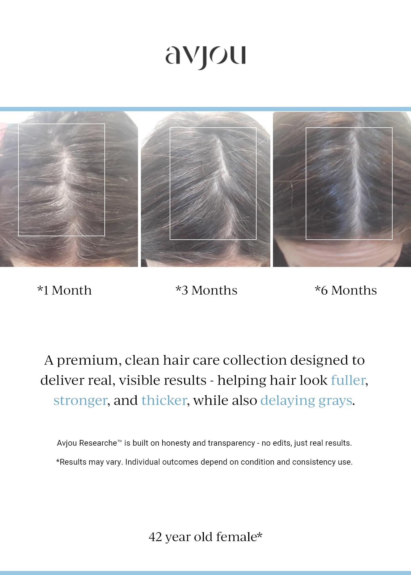 Avjou Researche™ Scalp Serum – Thicker, Fuller-Looking Hair + Targets Visible Signs of Premature Greying – 3 Patented Ingredients – Backed by Cosmetic Science – Oil-Free, All Hair Types, 1.7 oz
