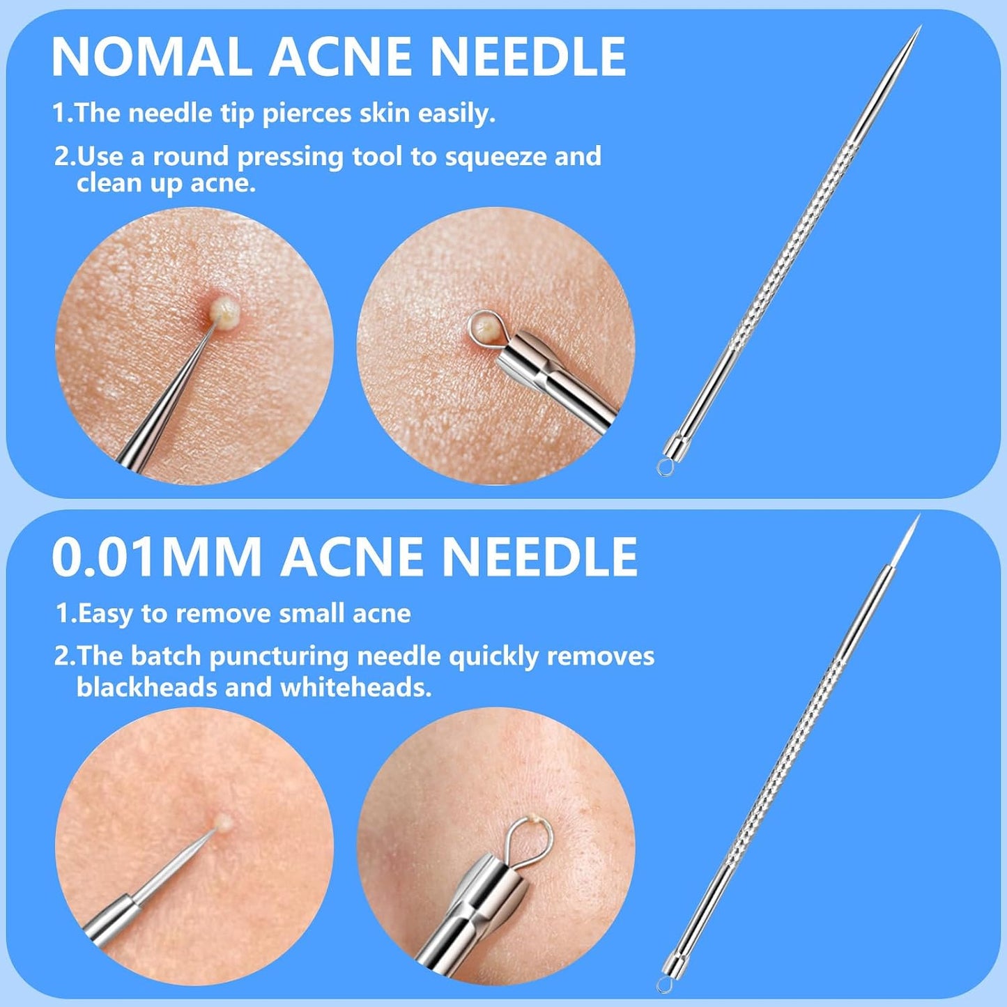 Blackhead Remover Kit - 5PCS Professional Stainless Steel Comedone Extractors for Acne & Blemish Removal | Curved Tweezers Included