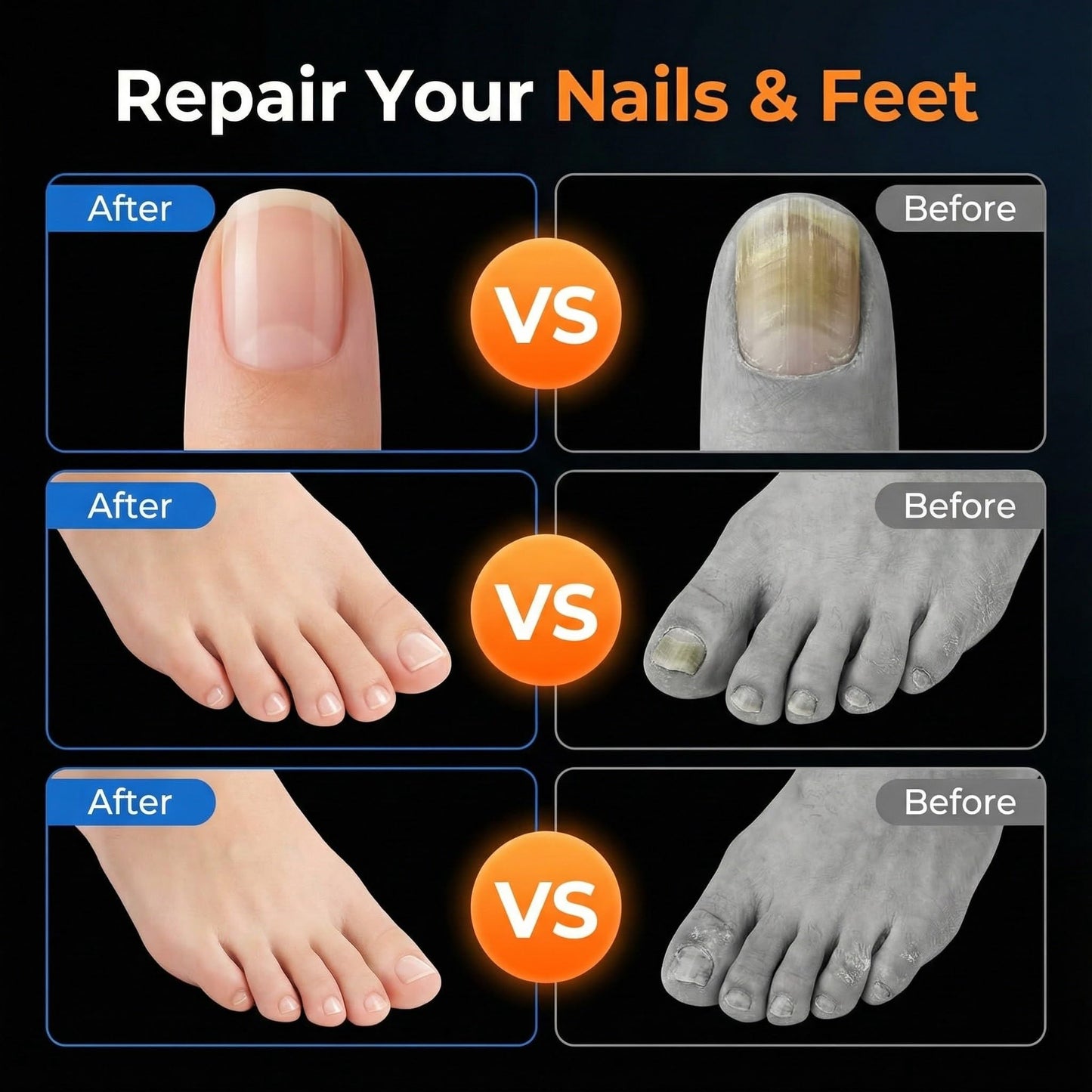 Athletes Foot Spray Treatment, Toenail Repair Extra Strength Pen