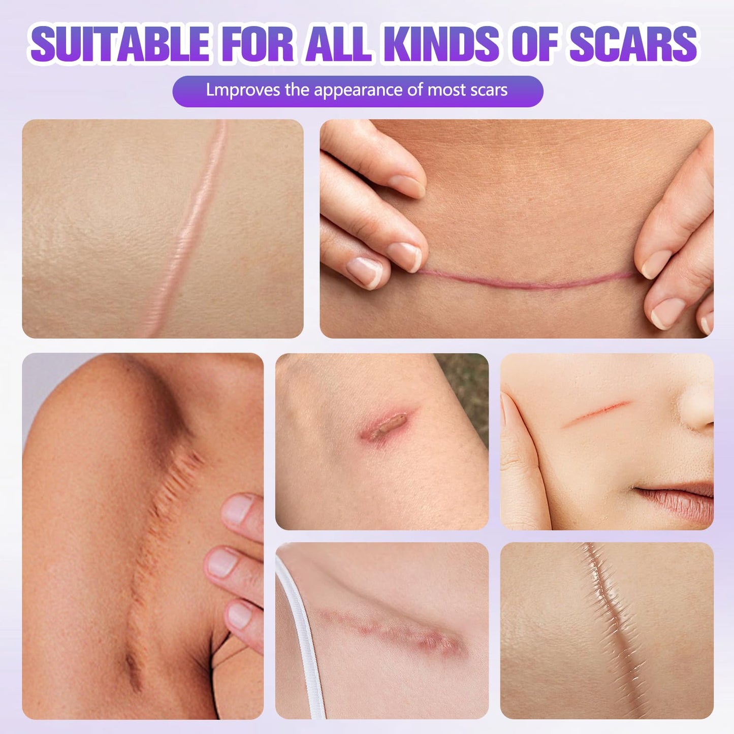 Silicone Collagen Scar Tape, Collagen Sheets for Scars & Wrinkle, Silicone Scar Removal Strips for Various Different Scars and Wrinkles, Old & New Scars for All Ages (1.6In * 60In)