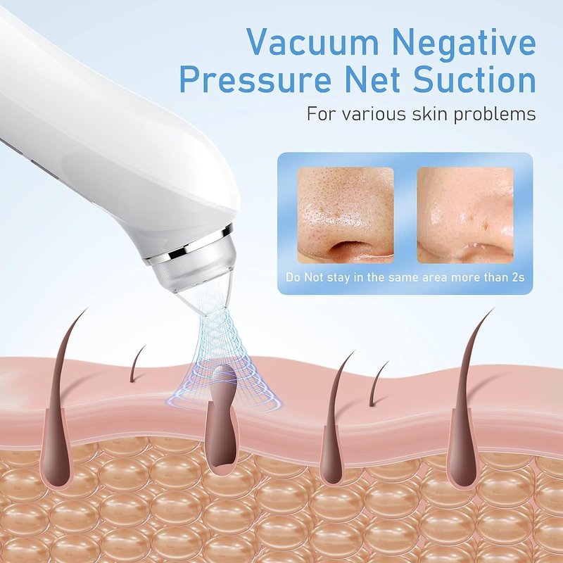 Blackhead Remover Vacuum - USB Pore Cleaner with Camera | 3 Modes & 6 Suction Heads, Light Pink