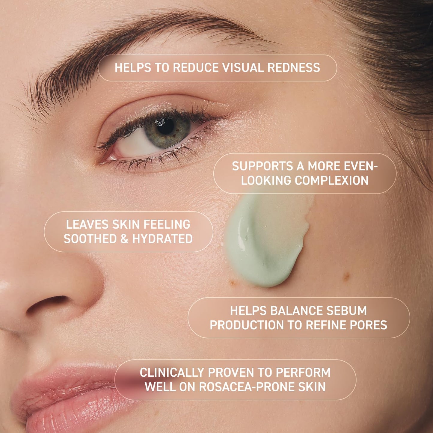 Prequel Skin Redness Reform Sulfur Cleanser – Calming Face Wash for Redness & Discomfort – Foaming Formula with Soothing Azelaic Acid & Colloidal Sulfur – Dermatologist-Developed Skincare – 6oz