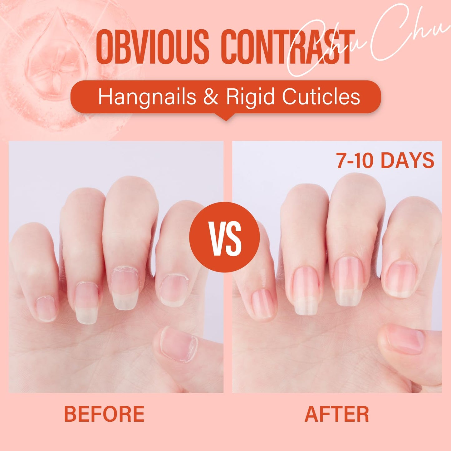 CHUCHU Cuticle Oil for Nails,Jojoba Nail Cuticle Oil Contain Vitamin B & E,Moisturizes Cuticle and Nail's Skin,Strengthens Nails,Prevents Hangnails and Chapped,Peach 15ml