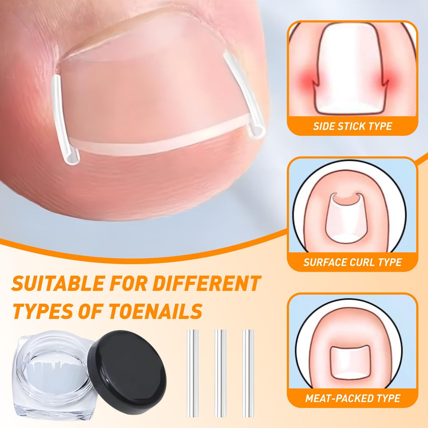 Ingrown Toenail Corrector Set, Ingrown Toenail Treatment Kit Including Correction Strips, Pedicure Tools & Breathable Patches - Professional Home Pedicure Care for Curved Toenails