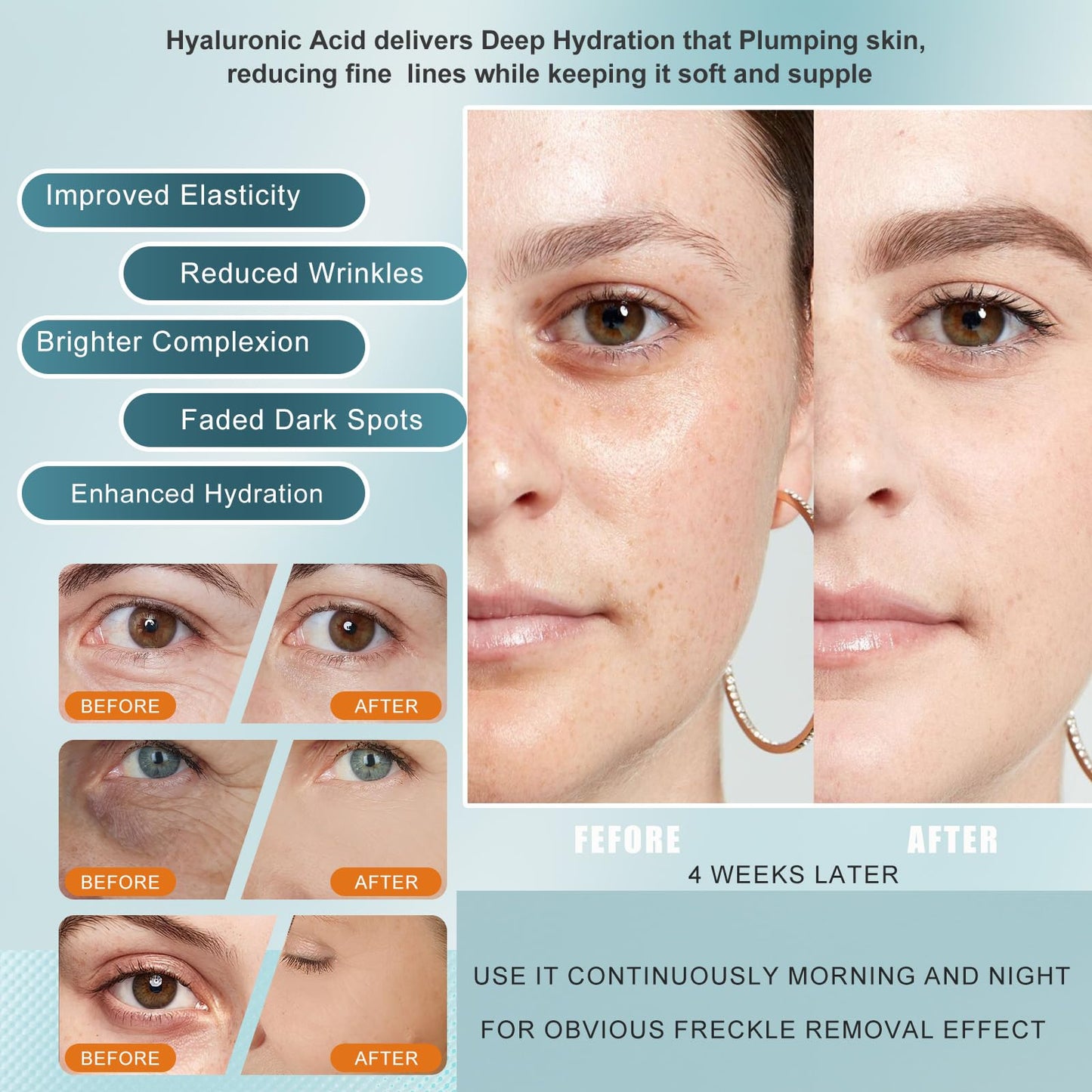 Vitamin C Serum for Face with Hyaluronic Acid & Peptides - Anti Aging Serum for Women & Men, Dark Spot Corrector for Firming, Hydrating Treatment to Reduce Wrinkles & Fine Lines, 1 fl oz