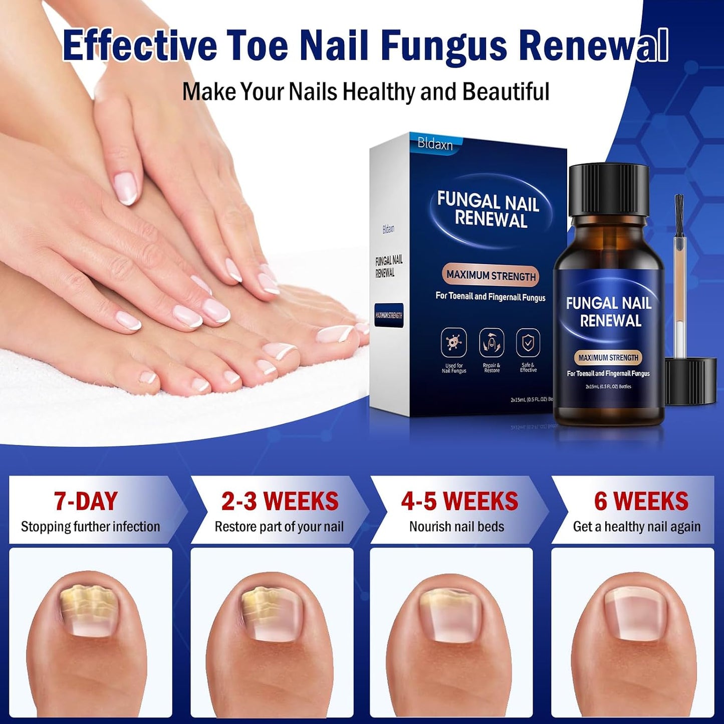 Toe Nail Fungus Renewal Treatment - Fast Acting Solution for Thick, Discolored Nails | 2-Pack