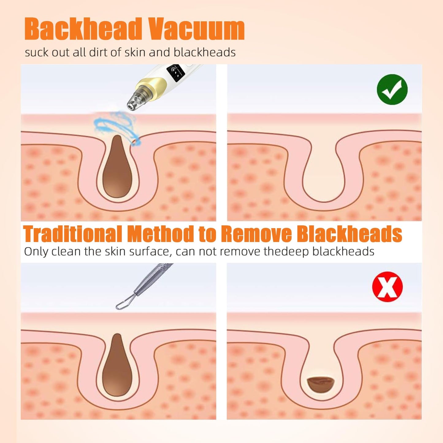 Pore Vacuum, USB Rechargeable Blackhead Remover Vacuum,3 Levels Adjustable Pore Vacuum Blackhead Remover, with 4 Suction Power,5 Probes,Face Vacuum Pore Cleanser for Women & Men-Light Purple