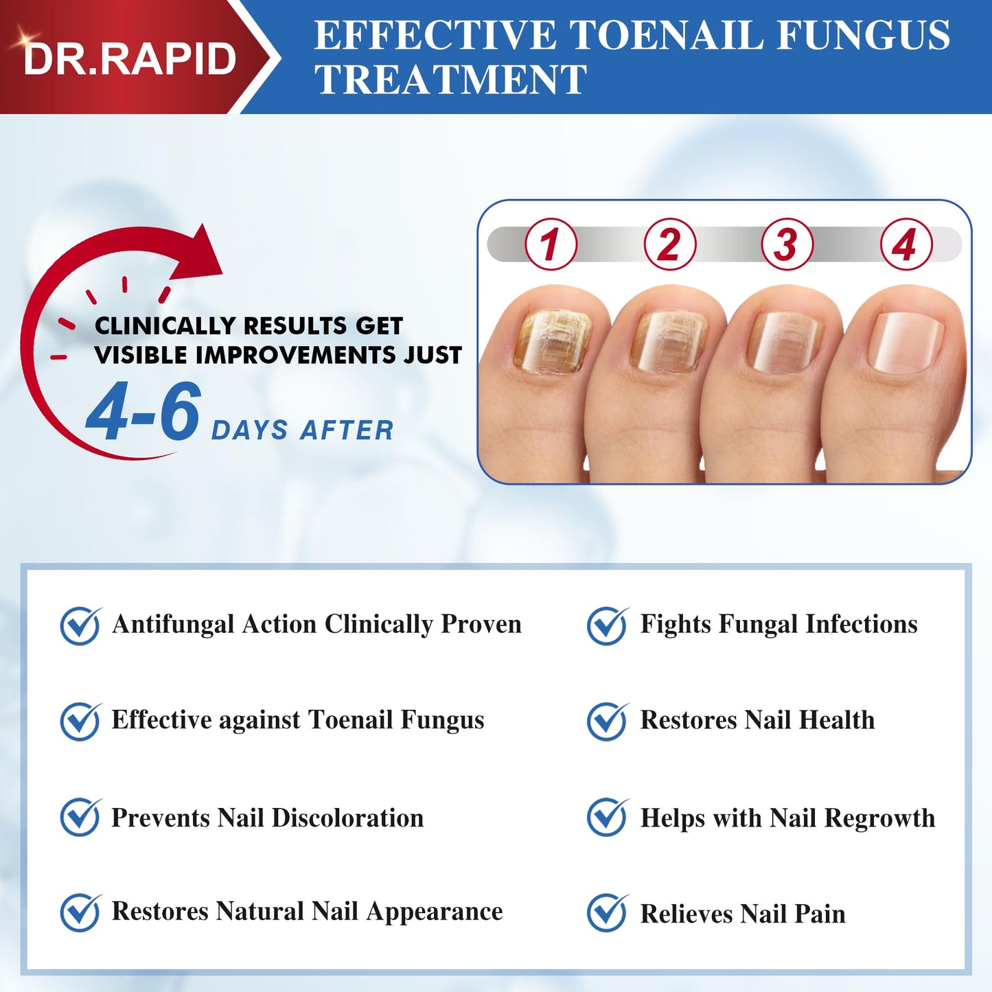 Toenail Fungus Treatment Extra Strength - Effective Antifungal Nail Repair Solution with Tea Tree Oil for Toenail & Nail Fungus, Fast Acting Treatment for Damaged Nails & Ingrown Toenail - 60ml/2fl oz