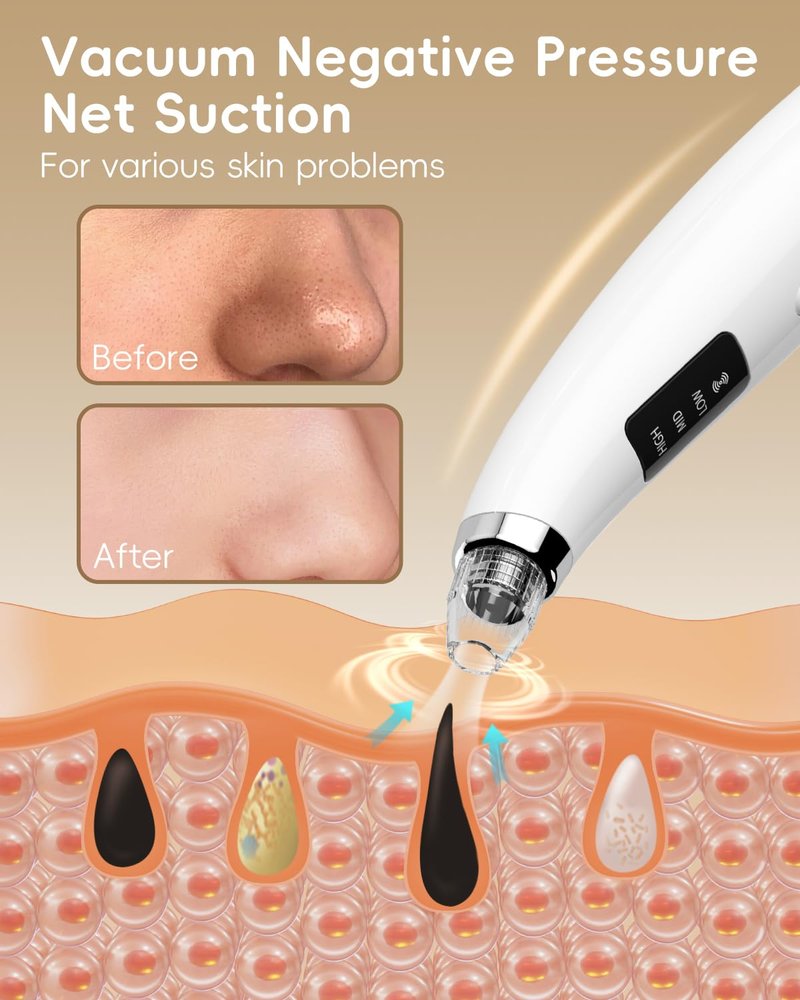 Pore Vacuum Blackhead Remover - Pore Extractor with 5 Attachments & 3 Suction Levels - Blackhead Remover Tools for Women and Men (White)