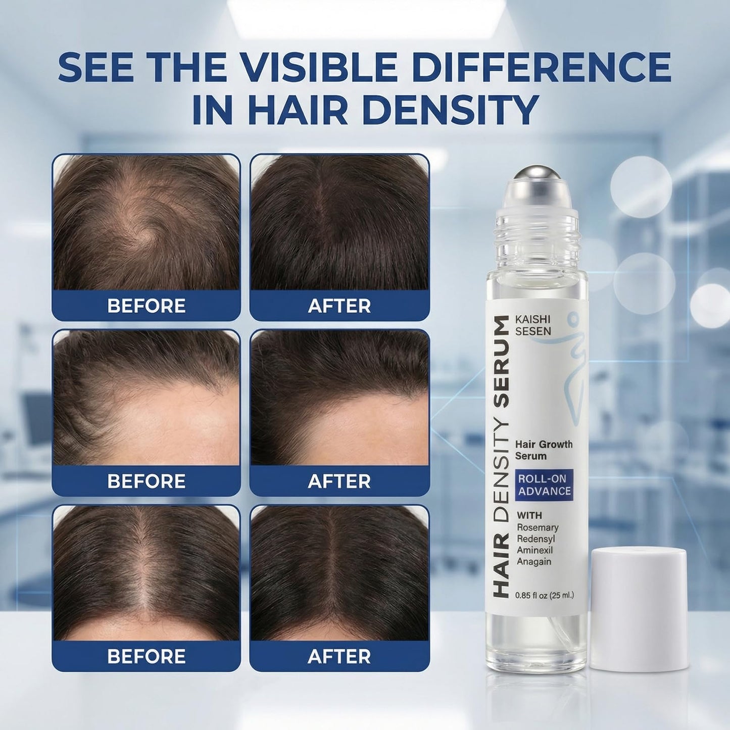 Hair Growth Serum Roll On with Rosemary & Redensyl – Hair Thickening Serum for Thinning Hair, For Thicker-Looking Hair & Helps Balance Scalp Oil, All Hair Types, Men & Women, 0.85 Fl Oz, 2-Pack