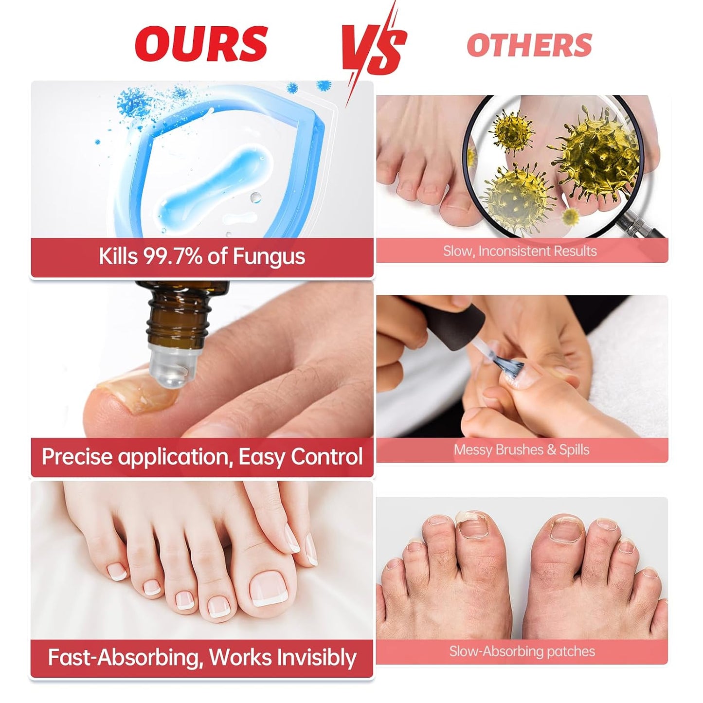 Nail Fungus Treatment - Extra Strength 1% Tolnaftate | Plant-Based Formula for Thickened Nails, 0.51 fl. oz.