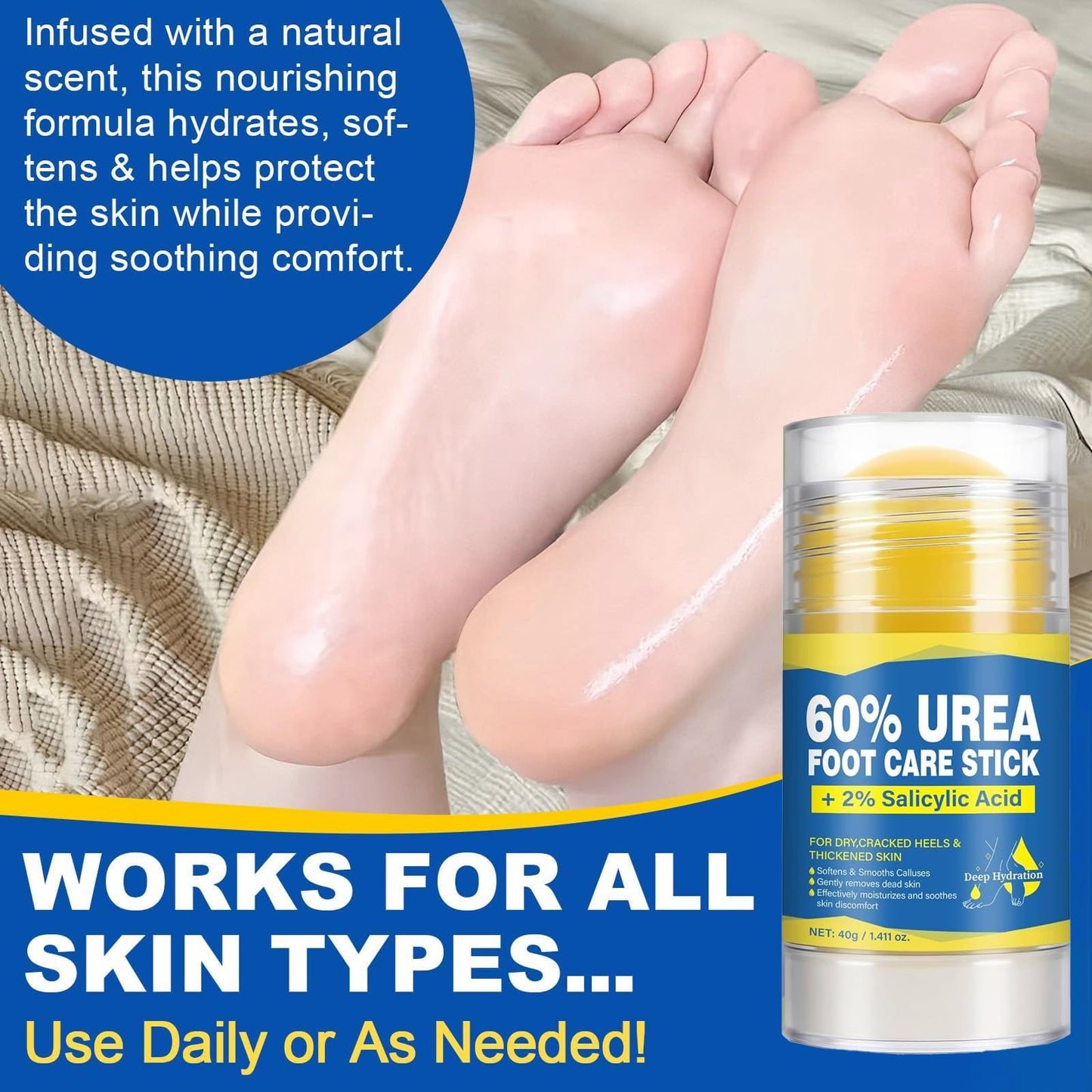 QVCQ 60% Urea Foot Cream Stick with 2% Salicylic Acid, Intensive Heel Balm for Dry Cracked Feet, Rough and Thick Skin, Fast-Absorbing Foot Repair Moisturizer for Heels, Elbows and Knees, 1.41 Oz