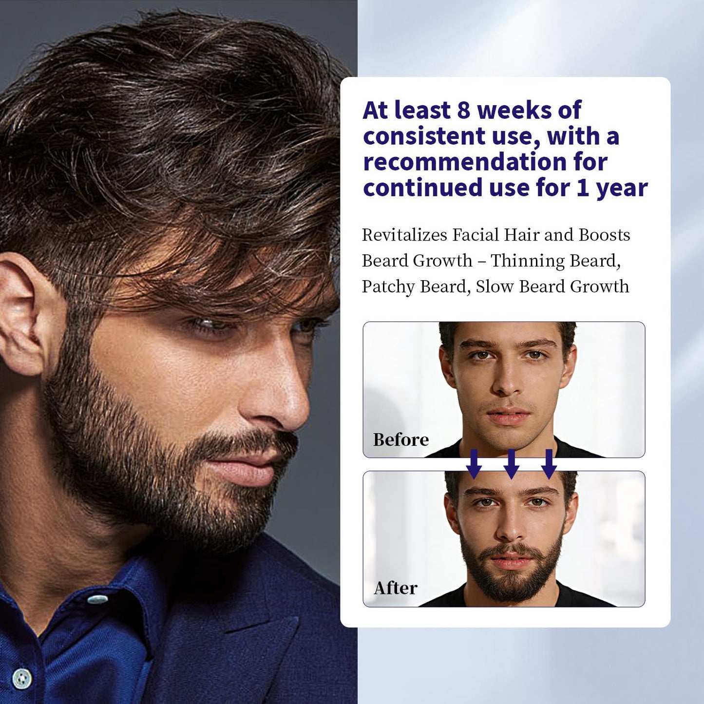 Minoxidil for Men & Hair Minoxidi with 5% Minoxidil Biotin and Rosemary & for Hair Beard Regrowth Treatments Extra Strength Hair Loss Solution, Total 160 ml / 5.42 fl oz for 3 Months (Pack of 2)