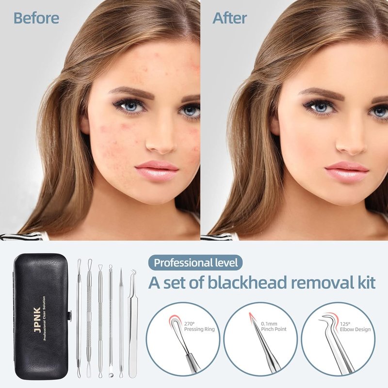 Blackhead Remover Kit - Comedone Extractor Tool for Acne Treatment | 6-Piece Set