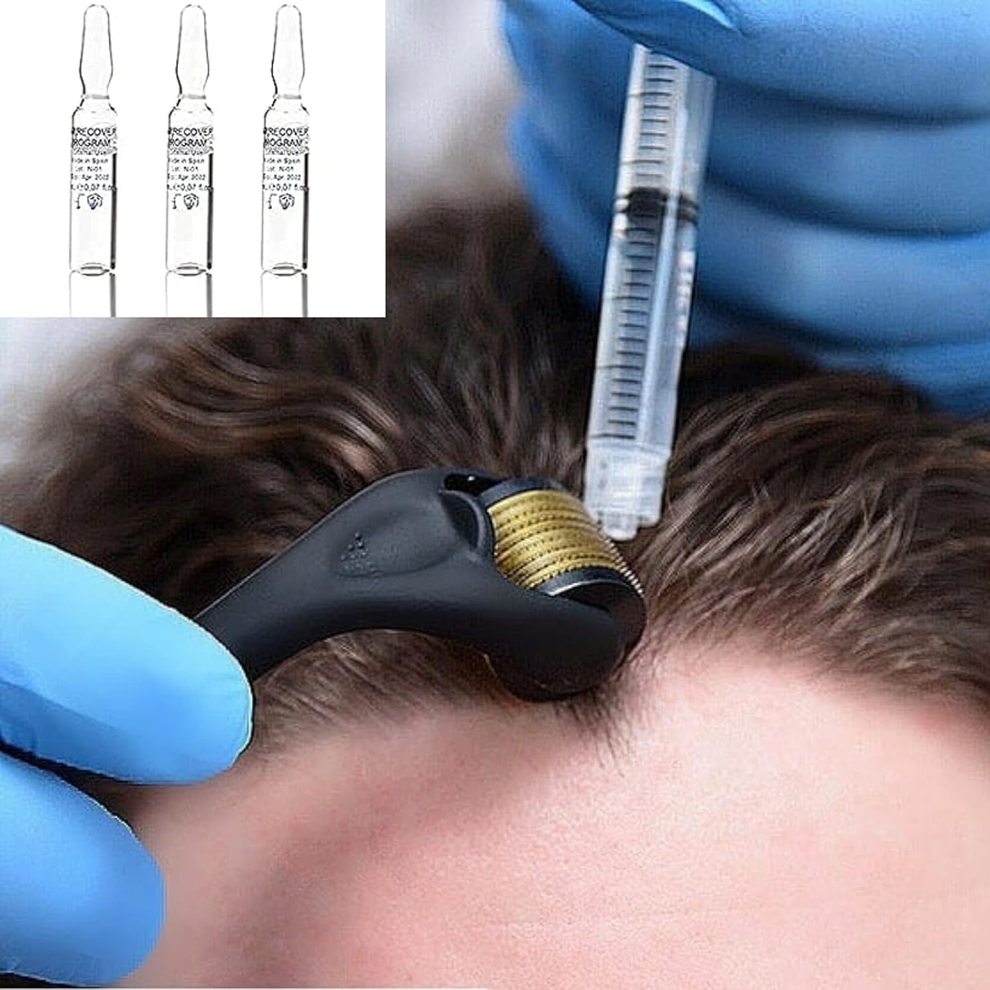 Hair Growth Serum | 7-Week Regrowth Kit with Biotin, Caffeine & Peptides for Thinning Hair - 5x5mL
