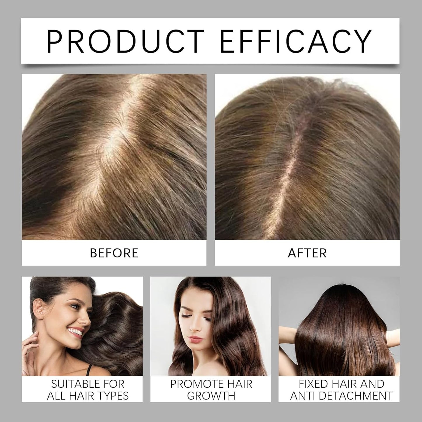 Hair Serum Bundle - Thinning Hair Treatment with Plant-Based Actives | Scalp Serum for Men & Women, Sulfate-Free