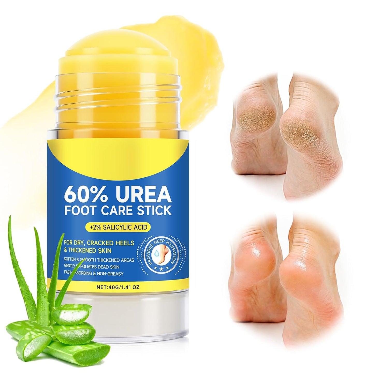Urea Cream Stick with Salicylic Acid - Maximum Strength Foot Cream for Dry Cracked Heels | Non-Greasy, Fast Acting, 2 oz