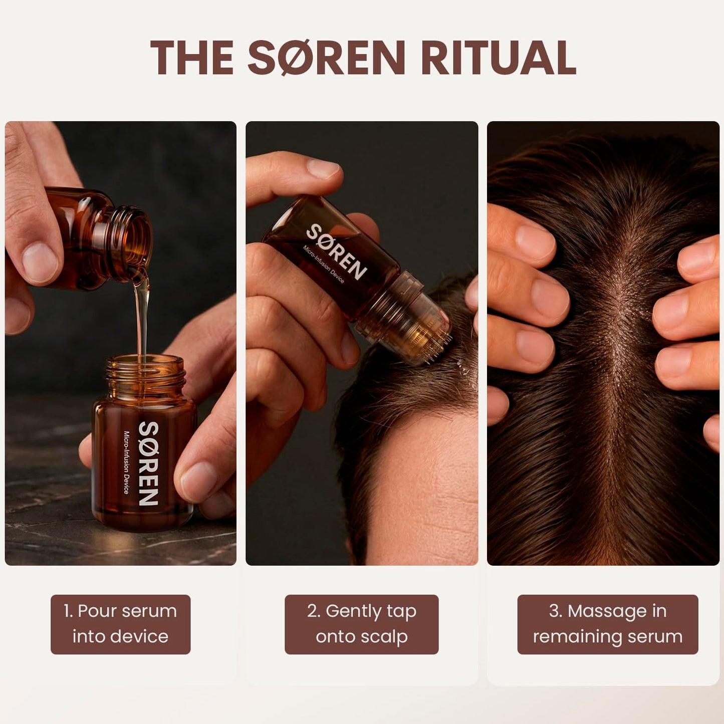 SØREN Micro Infusion Hair Renewal System by SOREN – Saw Palmetto & Peptide Scalp Treatment Kit | Supports Fuller, Thicker-Looking Hair | Gold Microinfuse Applicator | 3 Month Supply
