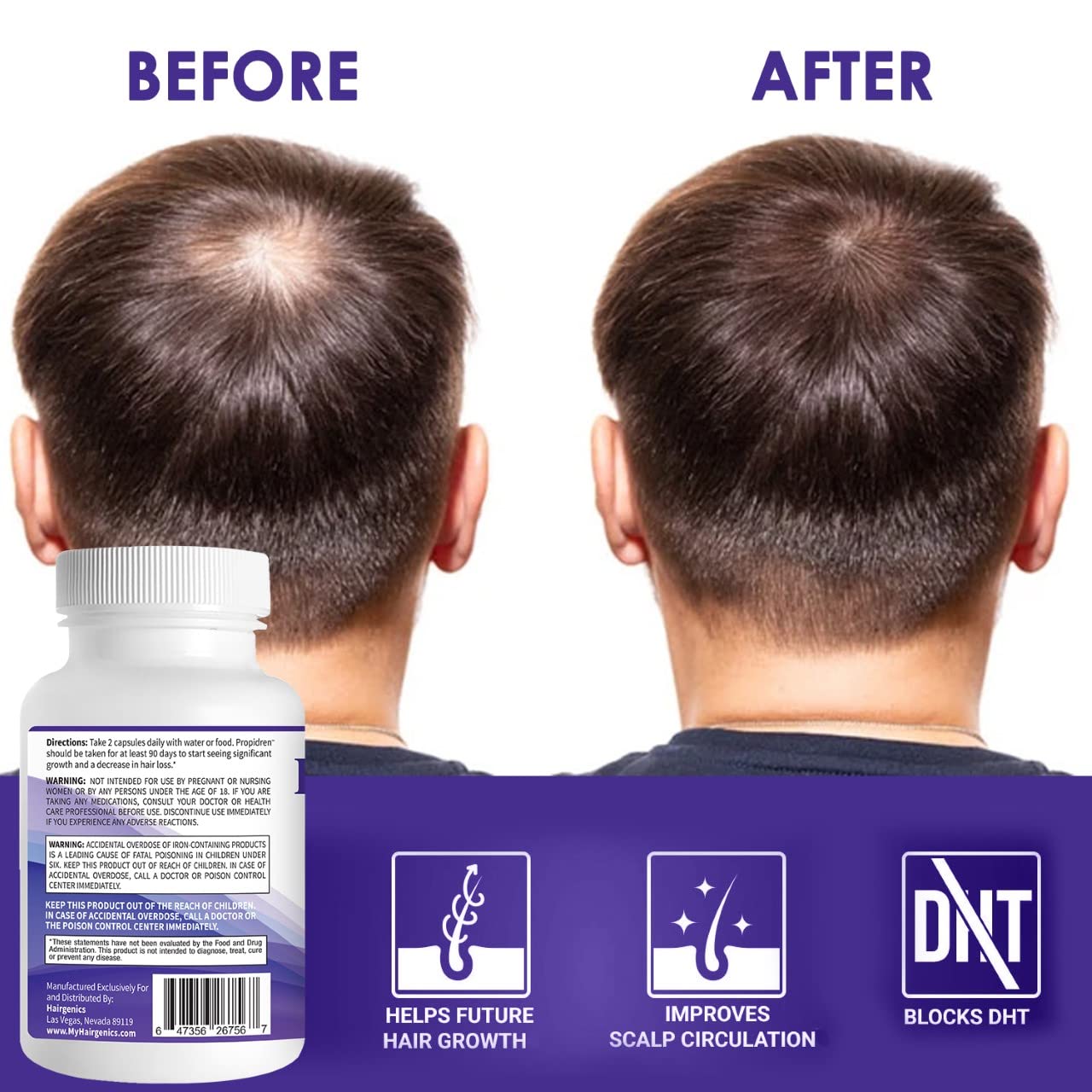 Propidren DHT Blocker & Hair Growth Pills To Stop Hair Loss and Regrow Hair