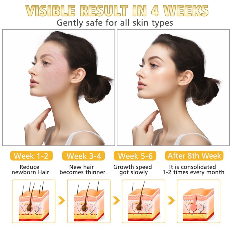 WAYCOM Facial Hair Remover Threading Hair Removal for Women Automatic Threader Machine Epilator for Fine Hairs on Face, Chin, Upper Lip, Arms Birthday Mother's Day Present