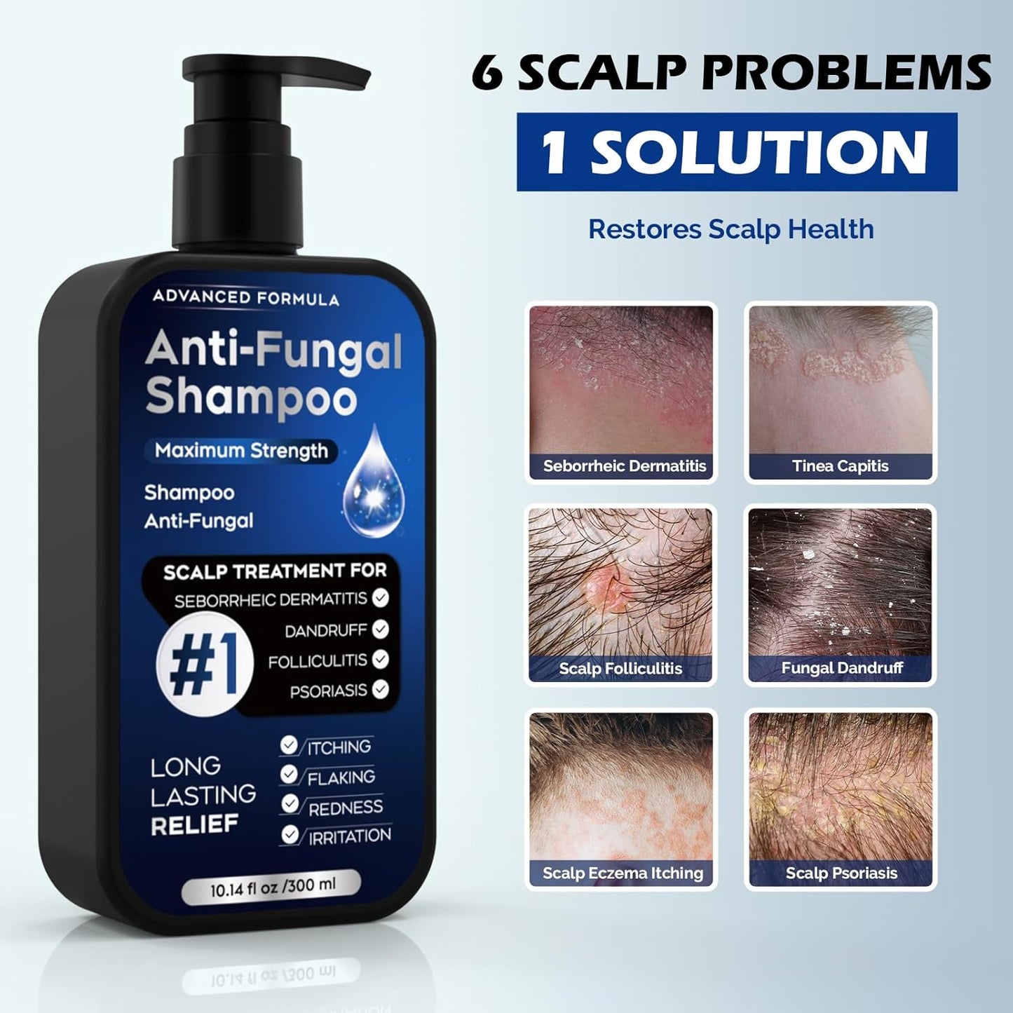 Antifungal Psoriasis Shampoo - Relieves Scalp Itching & Dryness | 10.1 Fl Oz, Sulfate-Free
